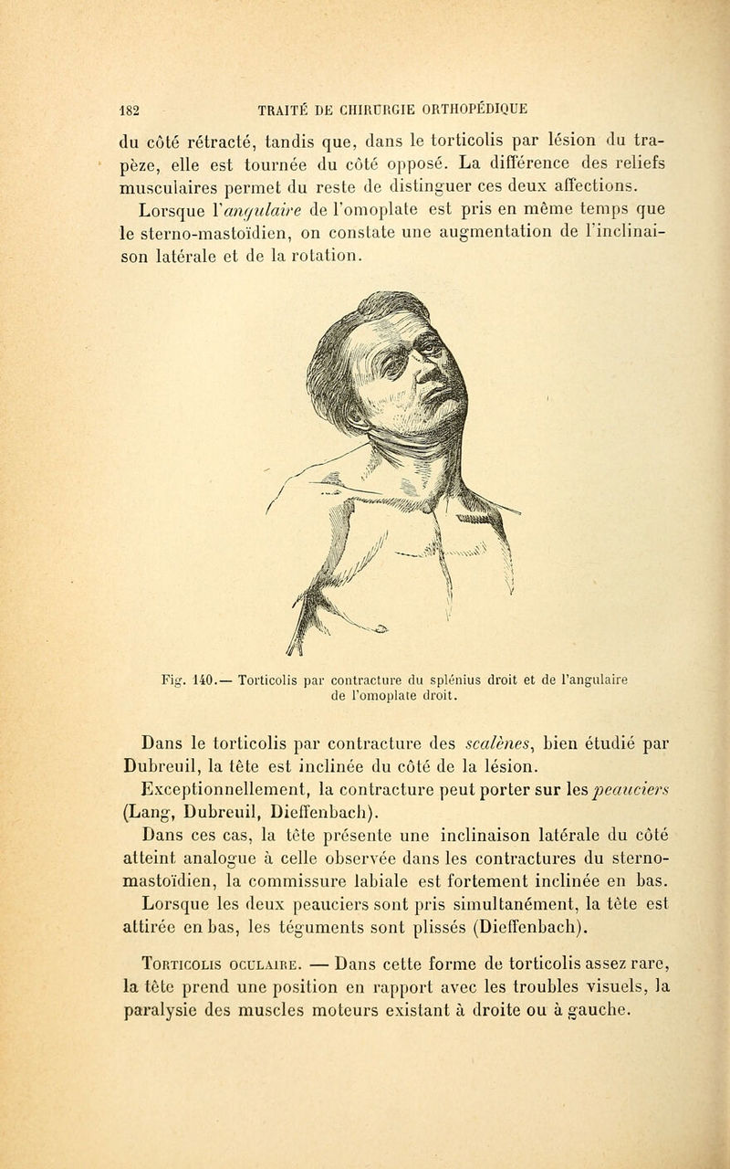 du côté rétracté, tandis que, dans le torticolis par lésion du tra- pèze, elle est tournée du côté opposé. La différence des reliefs musculaires permet du reste de distinguer ces deux affections. Lorsque Vangulaire de l'omoplate est pris en même temps que le sterno-mastoïdien, on constate une augmentation de l'inclinai- son latérale et de la rotation. Fig. 140.— Torticolis par contracture du splénius droit et de l'angulaire de l'omoplate droit. Dans le torticolis par contracture des scalènes^ bien étudié par Dubreuil, la tête est inclinée du côté de la lésion. Exceptionnellement, la contracture peut porter sur les peaucie)\s (Lang, Dubreuil, Dieffenbach). Dans ces cas, la tête présente une inclinaison latérale du côté atteint analogue à celle observée dans les contractures du sterno- mastoïdien, la commissure labiale est fortement inclinée en bas. Lorsque les deux peauciers sont pris simultanément, la tête est attirée en bas, les téguments sont plissés (Dieffenbach). Torticolis oculaire. —Dans cette forme de torticolis assez rare, la tête prend une position en rapport avec les troubles visuels, la paralysie des muscles moteurs existant à droite ou à gauche.