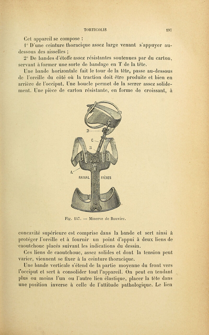 Cet appareil se compose : i° D'une ceinture thoracique assez large venant s'appuyer au- dessous des aisselles ; 2° De bandes d'étoffe assez résistantes soutenues par du carton, servant à former une sorte de bandage en T de la tête. Une bande horizontale fait le tour de la tête, passe au-dessous de l'oreille du côté où la traction doit être produite et bien en arrière de l'occiput. Une boucle permet de la serrer assez solide- ment. Une pièce de carton résistante, en forme de croissant, à Fig. 147. — Minerve de Bouvier. concavité supérieure est comprise dans la bande et sert ainsi à protéger l'oreille et à fournir un point d'appui à deux liens de caoutchouc placés suivant les indications du dessin. Ces liens de caoutchouc, assez solides et dont la tension peut varier, viennent se fixer à la ceinture thoracique. Une bande verticale s'étend de la partie moyenne du front vers l'occiput et sert à consolider tout l'appareil. On peut en tendant plus ou moins l'un ou l'autre lien élastique, placer la tète dans une position inverse à celle de l'attitude pathologique. Le lien