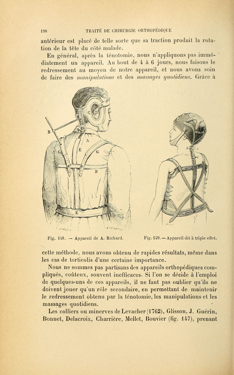 antérieur est placé de telle sorte que sa traction produit la rota- tion de la tête du côté malade. En général, après la ténotomie, nous n'appliquons pas immé- diatement un appareil. Au bout de 4 à 6 jours, nous faisons le redressement au moyen de notre appareil, et nous avons soin de faire des mani'pulations et des massages quotidiens. Grâce à €'^- Fig. 148. — Appareil de A. Richard. Fig. 149. — Appareil dit à triple effet. cette méthode, nous avons obtenu de rapides résultats, même dans les cas de torticolis d'une certaine importance. Nous ne sommes pas partisans des appareils orthopédiques com- pliqués, coûteux, souvent inefficaces- Si l'on se décide à l'emploi de quelques-uns de ces appareils, il ne faut pas oublier qu'ils ne doivent jouer qu'un rôle secondaire, en permettant de maintenir le redressement obtenu par la ténotomie, les manipulations et les massages quotidiens. Les colliers ou minerves deLevacher (1762), Glisson, J. Guérin, Bonnet, Delacroix, Charrière, Mellet, Bouvier (fig. 147), prenant