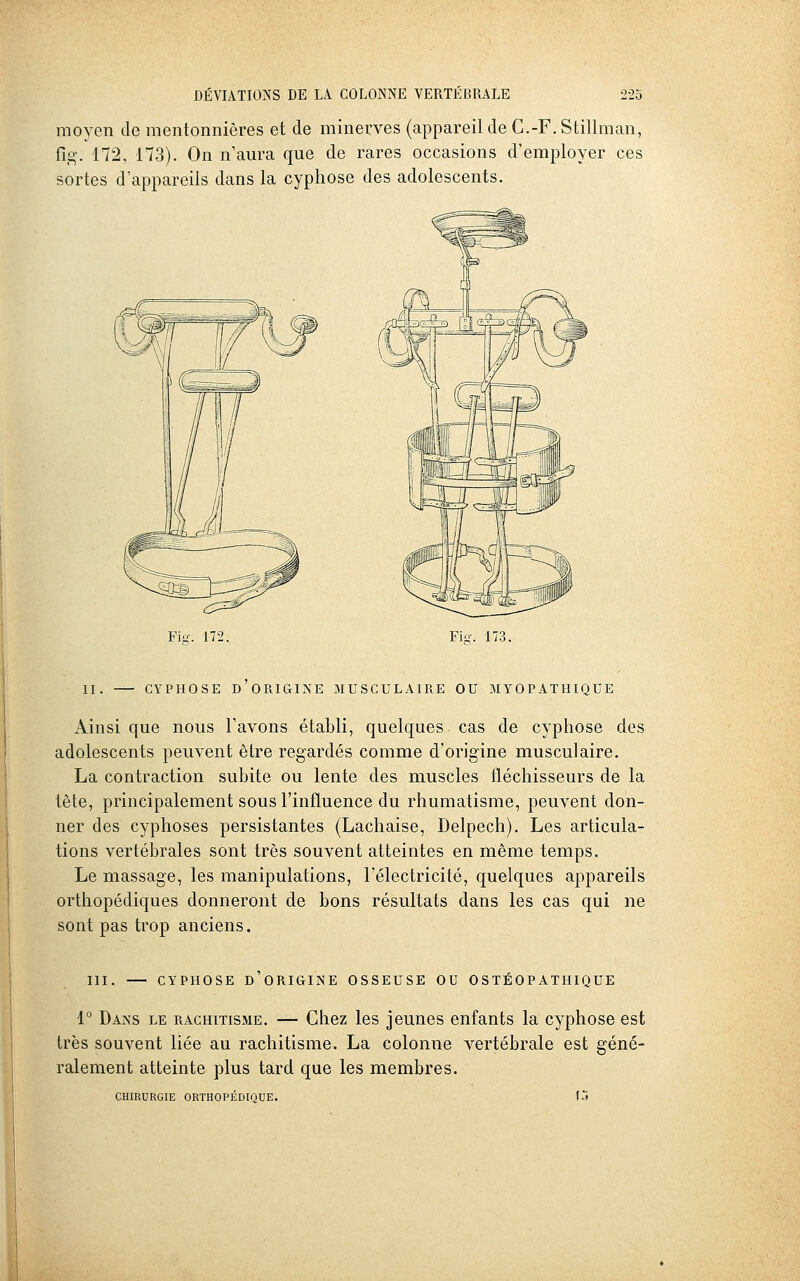 moyen de mentonnières et de minerves (appareil de C.-F. Stillman, fîg. 172, 173). On n'aura que de rares occasions d'employer ces sortes d'appareils dans la cyphose des adolescents. Fio-. 172. Fio-. 173. II. CYPHOSE D ORIGINE MUSCULAIRE OU MYOPAïHIQUE Ainsi que nous l'avons établi, quelques cas de cyphose des adolescents peuvent être regardés comme d'origine musculaire. La contraction subite ou lente des muscles fléchisseurs de la tête, principalement sous l'influence du rhumatisme, peuvent don- ner des cyphoses persistantes (Lachaise, Delpech), Les articula- tions vertébrales sont très souvent atteintes en même temps. Le massage, les manipulations, l'électricité, quelques appareils orthopédiques donneront de bons résultats dans les cas qui ne sont pas trop anciens. m. CYPHOSE d'origine OSSEUSE OU OSTÉOPATHIQUE 1° Dans le rachitisme. — Chez les jeunes enfants la cyphose est très souvent liée au rachitisme. La colonne vertébrale est géné- ralement atteinte plus tard que les membres. CHIRURGIE ORTHOPÉDIQUE. 1j