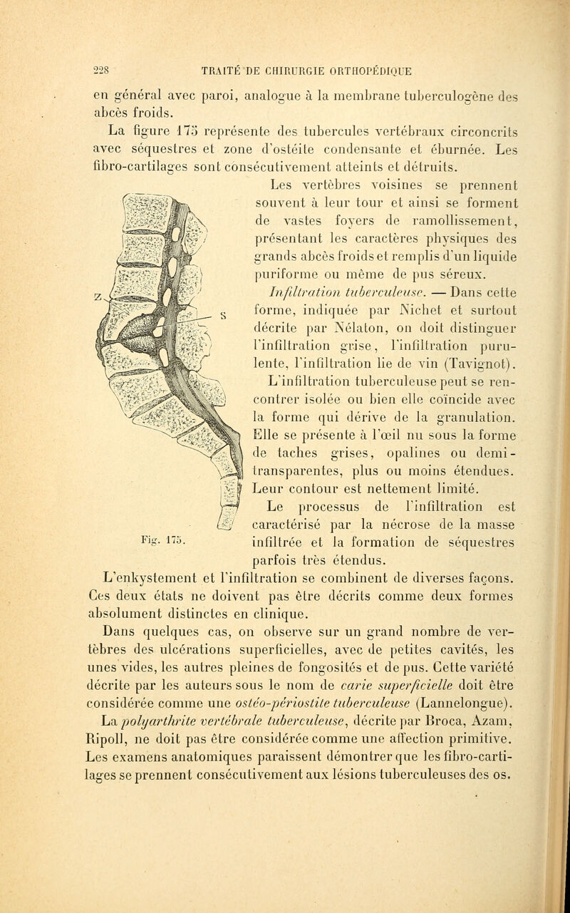 en général avec paroi, analogue à la membrane tuberculogône des abcès froids. La figure 175 représente des tubercules vertébraux circoncrits avec séquestres et zone d'ostéite condensante et éburnée. Les fibro-cartilages sont consécutivement atteints et détruits. Les vertèbres voisines se prennent souvent à leur tour et ainsi se forment de vastes foyers de ramollissement, présentant les caractères physiques des grands abcès froids et remplis d'un liquide puriforme ou même de pus séreux. Infiltration tuberculeuse. — Dans cette forme, indiquée par JXichet et surtout décrite par Nélaton, on doit distinguer l'infiltration grise, l'infiltration puru- lente, l'infiltration lie de vin (Tavignot), L'infiltration tuberculeuse peut se ren- contrer isolée ou bien elle coïncide avec la forme qui dérive de la granulation. Elle se présente à l'œil nu sous la forme de taches grises, opalines ou demi- transparentes, plus ou moins étendues. Leur contour est nettement limité. Le processus de l'infiltration est caractérisé par la nécrose de la masse infiltrée et la formation de séquestres parfois très étendus. L'enkystement et l'infiltration se combinent de diverses façons. Ces deux états ne doivent pas être décrits comme deux formes absolument distinctes en clinique. Dans quelques cas, on observe sur un grand nombre de ver- tèbres des ulcérations superficielles, avec de petites cavités, les unes vides, les autres pleines de fongosités et de pus. Cette variété décrite par les auteurs sous le nom de carie superficielle doit être considérée comme une ostéo-périostite tuberculeuse (Lannelongue). \a?i. polyarthrite vertébrale tuberculeuse.^ décrite par Broca, Azam, Ripoll, ne doit pas être considérée comme une affection primitive. Les examens anatomiques paraissent démontrer que les fibro-carti- lages se prennent consécutivement aux lésions tuberculeuses des os.