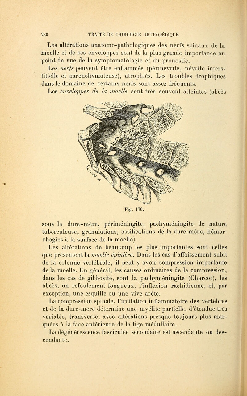Les altérations anatomo-pathologiques des nerfs spinaux de la moelle et de ses enveloppes sont de la plus grande importance au point de vue de la symptomalologie et du pronostic. Les nerfs peuvent être enflammés (périnévrite, névrite inters- titielle et parenchymateuse), atrophiés. Les troubles trophiques dans le domaine de certains nerfs sont assez fréquents. Les enveloppes de la moelle sont très souvent atteintes (abcès Fiff. 176. sous la dure-mère, périméningite, pachyméningite de nature tuberculeuse, granulations, ossifications de la dure-mère, hémor- rhagies à la surface de la moelle). Les altérations de beaucoup les plus importantes sont celles que présentent la moelle épinière. Dans les cas d'affaissement subit de la colonne vertébrale, il peut y avoir compression importante delà moelle. En général, les causes ordinaires de la compression, dans les cas de gibbosité, sont la pachyméningite (Charcot), les abcès, un refoulement fongueux, l'inflexion rachidienne, et, par exception, une esquille ou une vive arête. La compression spinale, l'irritation inflammatoire des vertèbres et de la dure-mère détermine une myélite partielle, d'étendue très variable, transverse, avec altérations presque toujours plus mar- quées à la face antérieure de la tige médullaire. La dégénérescence fasciculée secondaire est ascendante ou des- cendante.