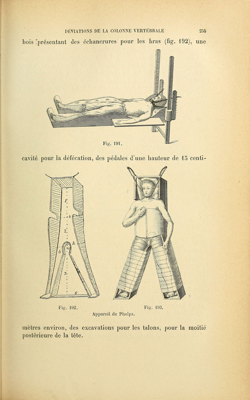 bois [présentant des échancrures pour les bras (fig. 192), une Fig. 191. cavité pour la défécation, des pédales d'une hauteur de 15 centi- Fiff. 192. Fiq-. 193. Appareil de Phelps. mètres environ, des excavations pour les talons, pour la moitié postérieure de la tête.