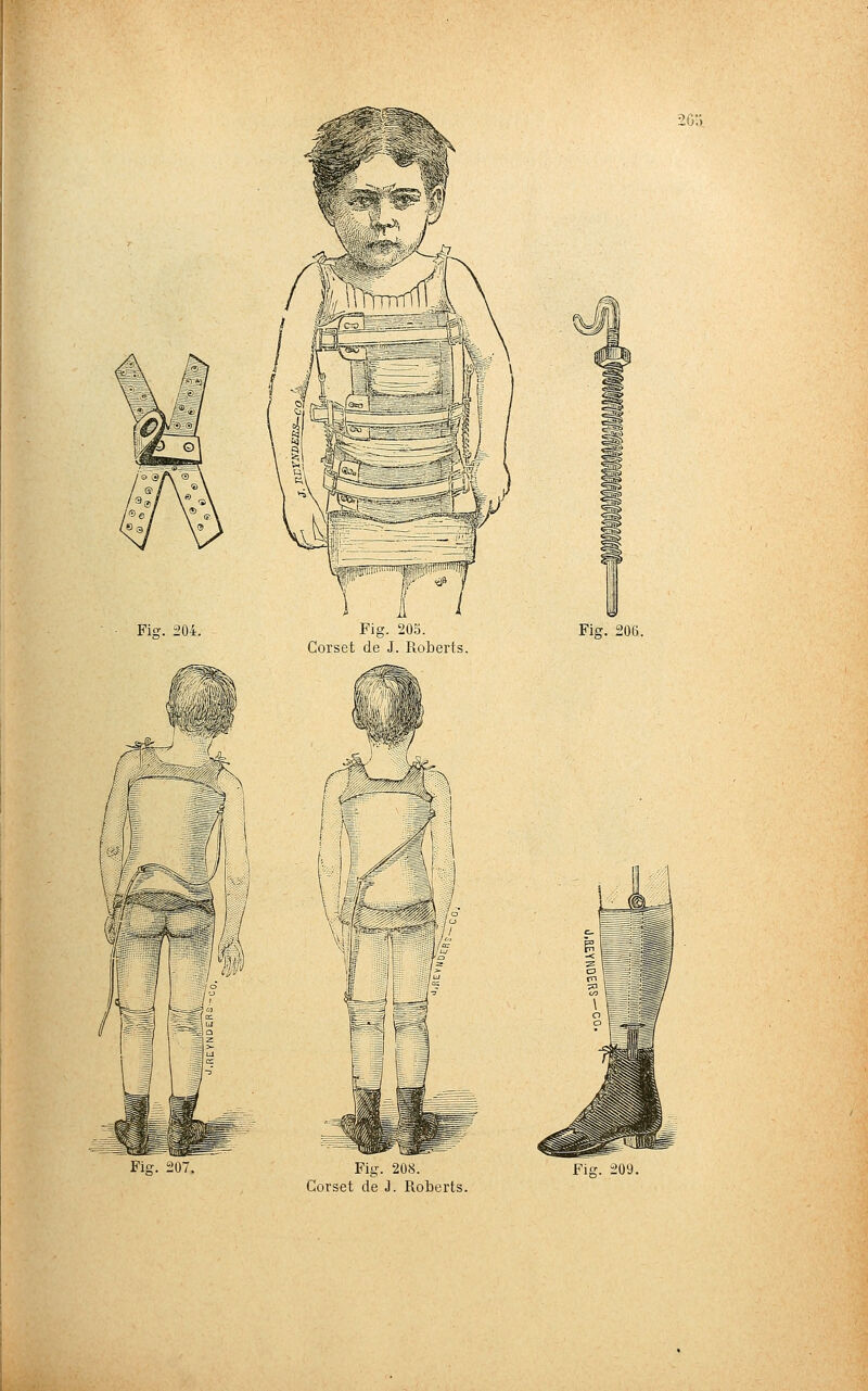 20:» Coiset de J Roberts. Corset de J. Roberts.