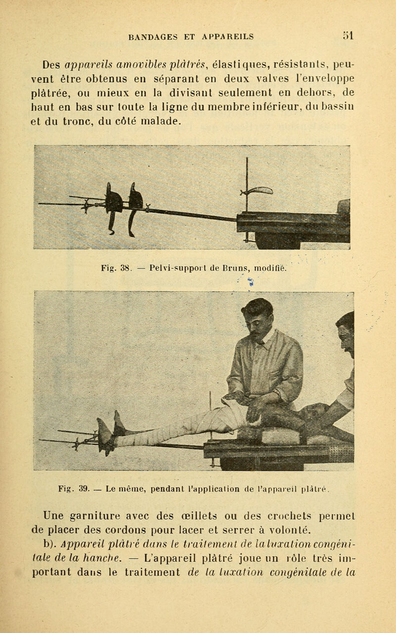 Des appareils amovibles plâtrés, élastiques, résistants, peu- vent être obtenus en séparant en deux valves l'enveloppe plâtrée, ou mieux en la divisant seulement en dehors, de haut en bas sur toute la ligne du membre inférieur, du bassin et du tronc, du côté malade. Fig. 38. — Pelvi-support de Bruns, modifié. Fig. 39. — Le même, pendant l'application de l'appareil plàlré. Une garniture avec des œillets ou des crochets permet de placer des cordons pour lacer et serrer à volonté. b). Appareil plâtré dans le traitement de la luxation congéni- tale de la hanche. — L'appareil plâtré joue un rôle très im- portant dans le traitement de la luxation congénitale de la