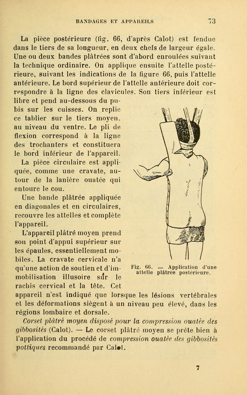 La pièce postérieure (fig. 66, d'après Calot) est fendue dans le tiers de sa longueur, en deux chefs de largeur égale. Une ou deux bandes plâtrées sont d'abord enroulées suivant la technique ordinaire. On applique ensuite l'attelle posté- rieure, suivant les indications de la figure 66, puis l'attelle antérieure. Le bord supérieur de l'attelle antérieure doit cor- respondre à la ligne des clavicules. Son tiers inférieur est libre et pend au-dessous du pu- bis sur les cuisses. On replie ce tablier sur le tiers moyen, au niveau du ventre. Le pli de flexion correspond à la ligne des trochanters et constituera le bord inférieur de l'appareil. La pièce circulaire est appli- quée, comme une cravate, au- tour de la lanière ouatée qui entoure le cou. Une bande plâtrée appliquée en diagonales et en circulaires, recouvre les attelles et complète l'appareil. L'appareil plâtré moyen prend son point d'appui supérieur sur les épaules, essentiellement mo- biles. La cravate cervicale n'a qu'une action de soutien et d'im- mobilisation illusoire siîr le rachis cervical et la tête. Cet appareil n'est indiqué que lorsque les lésions vertébrales et les déformations siègent à un niveau peu élevé, dans les régions lombaire et dorsale. Corset plâtré moyen disposé pour la compression ouatée des gibbositès (Calot). — Le corset plâtre moyen se prête bien à l'application du procédé de compression ouatée des gibbositès pottiques recommandé par Calât. Fig. 66. — Application d'une attelle plâtrée postérieure.