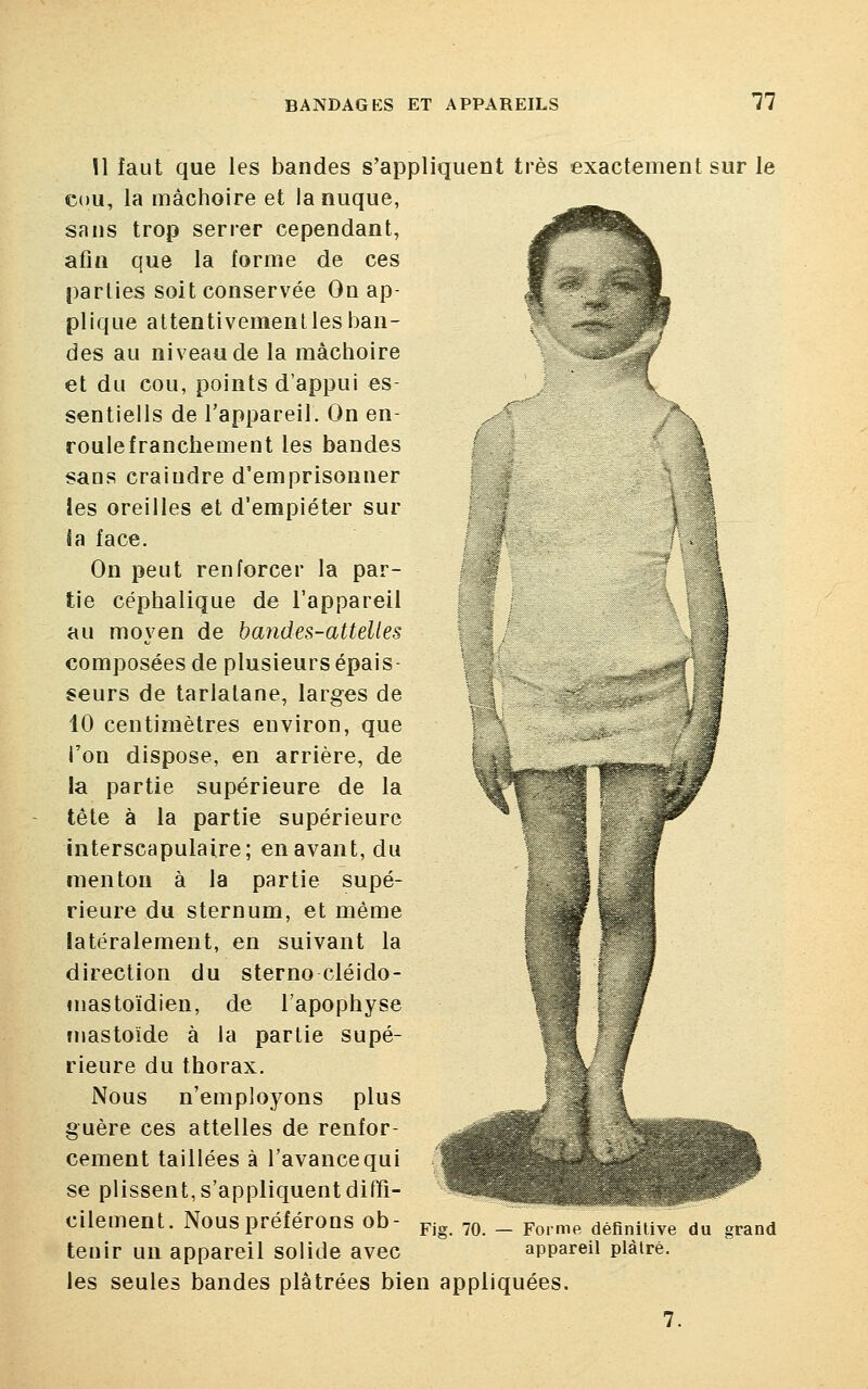 11 11 faut que les bandes s'appliquent très exactement sur le cou, la mâchoire et la nuque, sans trop serrer cependant, afin que la forme de ces parties soit conservée On ap- plique attentivement les ban- des au niveau de la mâchoire et du cou, points d'appui es- sentiels de l'appareil. On en- roulefranchement les bandes sans craindre d'emprisonner les oreilles et d'empiéter sur Sa face. On peut renforcer la par- tie céphalique de l'appareil au moyen de bandes-attelles composées de plusieurs épais- seurs de tarlatane, larges de 10 centimètres environ, que l'on dispose, en arrière, de la partie supérieure de la tête à la partie supérieure interscapulaire; en avant, du menton à la partie supé- rieure du sternum, et même latéralement, en suivant la direction du sterno cléido- uiastoïdien, de l'apophyse mastoïde à la partie supé- rieure du thorax. Nous n'employons plus guère ces attelles de renfor- cement taillées à l'avancequi se plissent, s'appliquent diffi- cilement. Nous préférons ob- tenir un appareil solide avec les seules bandes plâtrées bien appliquées. v -;■:? .,'• €ËÊMÈ,: Fig. 70. — Forme définitive du grand appareil plâtré.