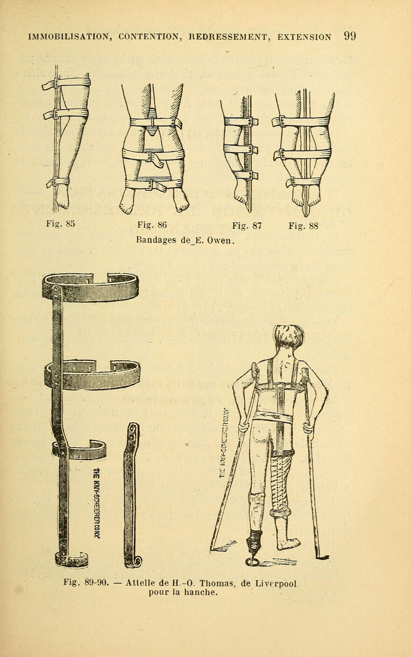 Fis. 85 Fig. 86 Fig. 87 Bandages de_E. Owen. Fig. 89-90. — Attelle de H.-O. Thomas, de Liverpool pour la hanche.