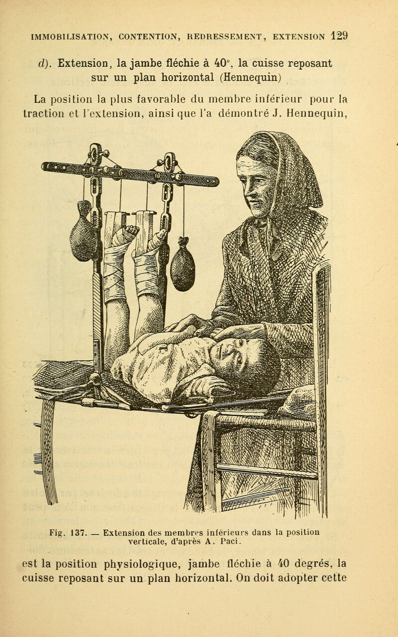 d). Extension, la jambe fléchie à 40°, la cuisse reposant sur un plan horizontal (Hennequin) La position la plus favorable du membre inférieur pour la traction et l'extension, ainsi que l'a démontré J. Hennequin, Fig. 137. — Extension des membres inférieurs dans la position verticale, d'après A. Paci. est la position physiologique, jambe fléchie à 40 degrés, la cuisse reposant sur un plan horizontal. On doit adopter cette