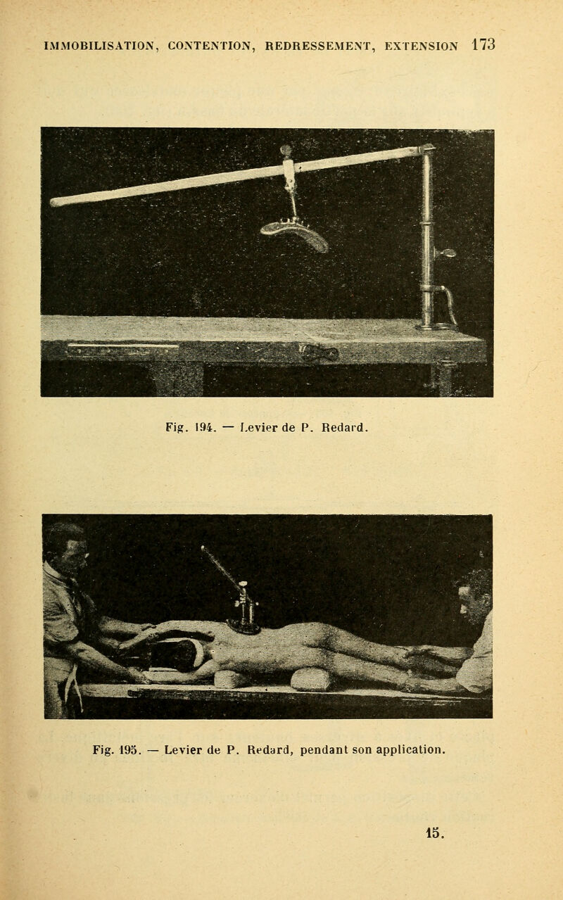 Fig. 194. — Levier de P. Redard. Fig. 195. — Levier de P. Redard, pendant son application. 15.