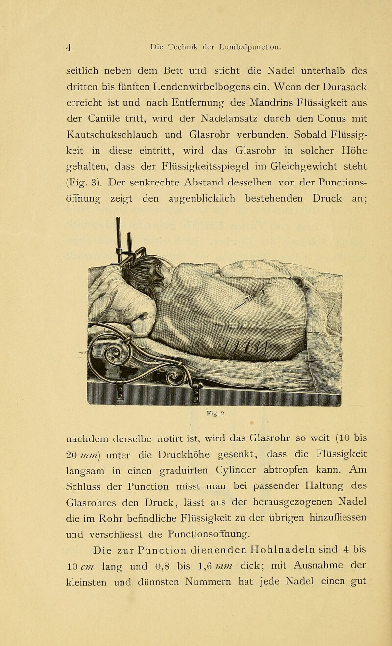 seitlich neben dem Bett und sticht die Nadel unterhalb des dritten bis fünften Lendenwirbelbogens ein. Wenn der Durasack erreicht ist und nach Entfernung des Mandrins Flüssigkeit aus der Canüle tritt, wird der Nadelansatz durch den Conus mit Kautschukschlauch und Glasrohr verbunden. Sobald Flüssig- keit in diese eintritt, wird das Glasrohr in solcher Höhe gehalten, dass der Flüssigkeitsspiegel im Gleichgewicht steht (Fig. 3). Der senkrechte Abstand desselben von der Punctions- öffnung zeigt den augenblicklich bestehenden Druck an; nachdem derselbe notirt ist, wird das Glasrohr so weit (10 bis 20 mm) unter die Druckhöhe gesenkt, dass die Flüssigkeit langsam in einen graduirten Cylinder abtropfen kann. Am Schluss der Function misst man bei passender Haltung des Glasrohres den Druck, lässt aus der herausgezogenen Nadel die im Rohr befindliche Flüssigkeit zu der übrigen hinzufliessen und verschliesst die Punctionsöffnung. Die zur Function dienenden Hohlnadeln sind 4 bis 10 C7n lang und 0,8 bis 1,^ mm dick; mit Ausnahme der kleinsten und dünnsten Nummern hat jede Nadel einen gut