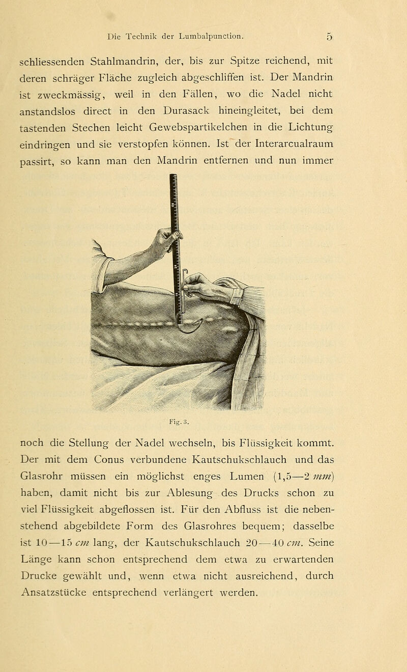 schliessenden Stahlmandrin, der, bis zur Spitze reichend, mit deren schräger Fläche zugleich abgeschliffen ist. Der Mandrin ist zweckmässig, weil in den Fällen, wo die Nadel nicht anstandslos direct in den Durasack hineingleitet, bei dem tastenden Stechen leicht Gewebspartikelchen in die Lichtung eindringen und sie verstopfen können. Ist der Interarcualraum passirt, so kann man den Mandrin entfernen und nun immer Fig. 3. noch die Stellung der Nadel wechseln, bis Flüssigkeit kommt. Der mit dem Conus verbundene Kautschukschlauch und das Glasrohr müssen ein möglichst enges Lumen (1,5—2 mm) haben, damit nicht bis zur Ablesung des Drucks schon zu viel Flüssigkeit abgeflossen ist. Für den Abfluss ist die neben- stehend abgebildete Form des Glasrohres bequem; dasselbe ist 10—15 (TZ/z lang, der Kautschukschlauch 20 — '^{) cm. Seine Länge kann schon entsprechend dem etwa zu erwartenden Drucke gewählt und, wenn etwa nicht ausreichend, durch Ansatzstücke entsprechend verlängert werden.