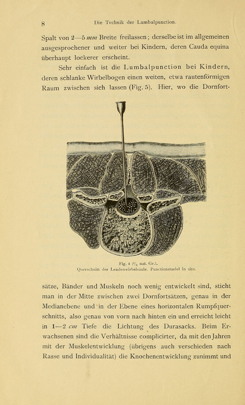 Spalt von 2—5 mm Breite freilassen ; derselbe ist im allgemeinen ausgesprochener und weiter bei Kindern, deren Cauda equina überhaupt lockerer erscheint. Sehr einfach ist die Lumbalpunction bei Kindern, deren schlanke Wirbelbogen einen weiten, etwa rautenförmigen Raum zwischen sich lassen (Fig. 5). Hier, wo die Dornfort- big. 4 (-/3 nat Gr ). Querschnitt der Lendenwirbelsäule. Punctionsnadel in situ. Sätze, Bänder und Muskeln noch wenig entwickelt sind, sticht man in der Mitte zwischen zwei Dornfortsätzen, genau in der Medianebene und in der Ebene eines horizontalen Rumpfquer- schnitts, also genau von vorn nach hinten ein und erreicht leicht in 1—2 cm Tiefe die Lichtung des Durasacks. Beim Er- wachsenen sind die Verhältnisse complicirter, da mit den Jahren mit der Muskelentwicklung (übrigens auch verschieden nach Rasse und Individualität) die Knochenentwicklung zunimmt und