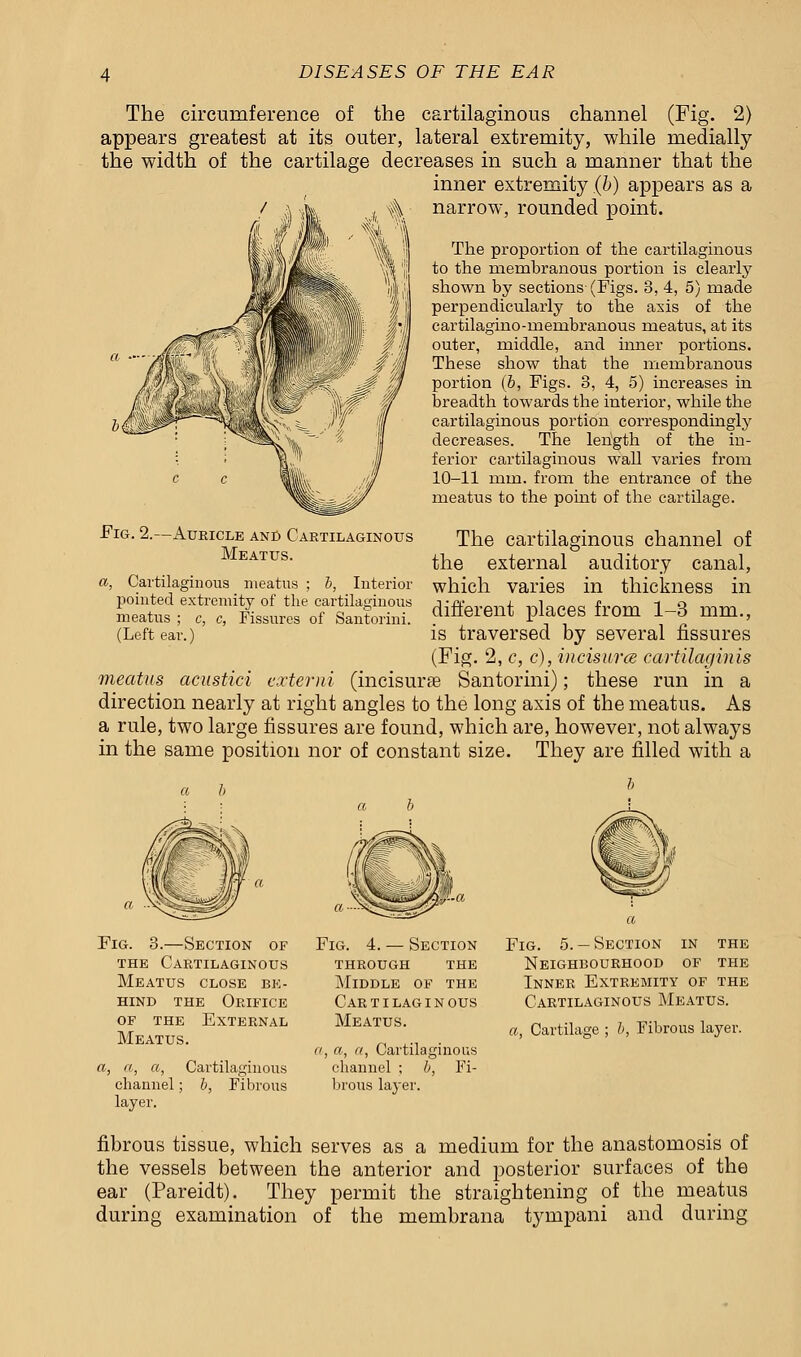 The circumference of the cartilaginous channel (Fig. 2) appears greatest at its outer, lateral extremity, while medially the width of the cartilage decreases in such a manner that the inner extremity (b) appears as a / a 4s, , 4 narrow, rounded point. The proportion of the cartilaginous to the membranous portion is clearly shown by sections (Figs. 3, 4, 5) made perpendicularly to the axis of the cartilagino-membranous meatus, at its outer, middle, and inner portions. These show that the membranous portion (b, Figs. 3, 4, 5) increases in breadth towards the interior, while the cartilaginous portion correspondingly decreases. The length of the in- ferior cartilaginous wall varies from 10-11 mm. from the entrance of the meatus to the point of the cartilage. Fig. 2.—Auricle and Cartilaginous Meatus. The cartilaginous channel of the external auditory canal, which varies in thickness in different places from 1-3 mm., is traversed by several fissures (Fig. 2, c, c), incisures cartilaginis meatus acustici externi (incisure Santorini); these run in a direction nearly at right angles to the long axis of the meatus. As a rule, two large fissures are found, which are, however, not always in the same position nor of constant size. They are filled with a Cartilaginous meatus ; b, Interior pointed extremity of the cartilaginous meatus ; c, c, Fissures of Santorini. (Left ear.) Fig. 3.—Section of the Cartilaginous Meatus close be- hind the Orifice of the External Meatus. a, a, a, Cartilaginous channel; b, Fibrous layer. Fig. 4. — Section through the Middle of the Cartilaginous Meatus. a, a, n, Cartilaginous channel ; b, Fi- brous layer. Fig. 5.— Section in the Neighbourhood of the Inner Extremity of the Cartilaginous Meatus. a, Cartilage ; b, Fibrous layer. fibrous tissue, which serves as a medium for the anastomosis of the vessels between the anterior and posterior surfaces of the ear (Pareidt). They permit the straightening of the meatus during examination of the membrana tympani and during