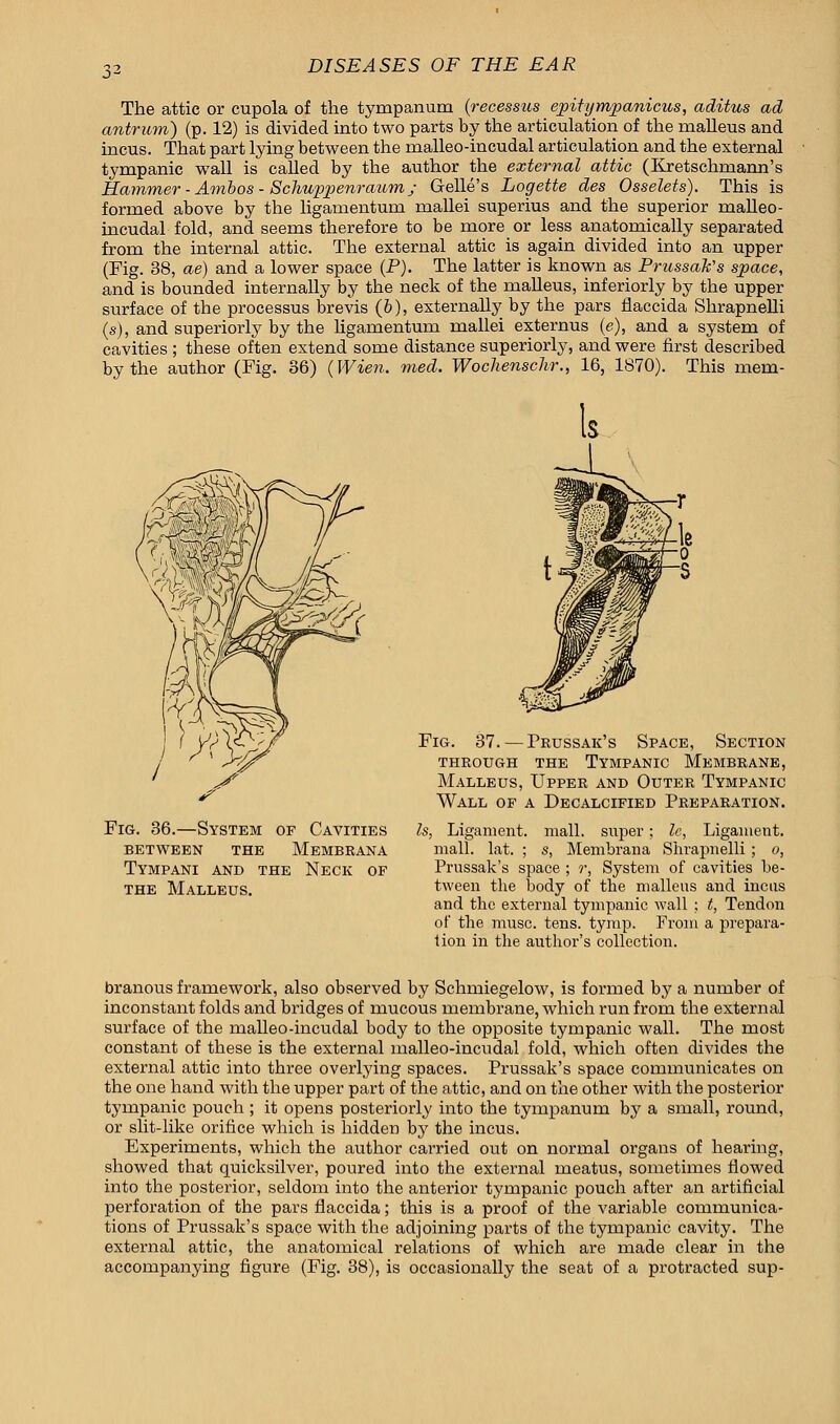 The attic or cupola of the tympanum (recessus epitympanicus, aditus ad antrum) (p. 12) is divided into two parts by the articulation of the malleus and incus. That part lying between the malleo-incudal articulation and the external tympanic wall is called by the author the external attic (Kretschmann's Hammer - Ainbos - Schuppenraum; Gelle's Logette des Osselets). This is formed above by the ligamentum mallei superius and the superior malleo- incudal fold, and seems therefore to be more or less anatomically separated from the internal attic. The external attic is again divided into an upper (Fig. 38, ae) and a lower space (P). The latter is known as Prussak's space, and is bounded internally by the neck of the malleus, inferiorly by the upper surface of the processus brevis (b), externally by the pars flaccida Shrapnelli (s), and superiorly by the hgamentum mallei externus (e), and a system of cavities ; these often extend some distance superiorly, and were first described by the author (Fig. 36) (Wien. med. Wochenschr., 16, 1870). This mem- Fig. 36.—System of Cavities BETWEEN THE MeMBRANA Tympani and the Neck of the Malleus. Fig. 37. — Prussak's Space, Section through the Tympanic Membrane, Malleus, Upper and Outer Tympanic Wall of a Decalcified Preparation. Is, Ligament, mall, super; fa, Ligament, mall. lat. ; s, Membrana Shrapnelli ; o, Prussak's space ; r, System of cavities be- tween the body of the malleus and incus and the external tympanic wall ; t, Tendon of the muse. tens. tymp. From a prepara- tion in the author's collection. branous framework, also observed by Schmiegelow, is formed by a number of inconstant folds and bridges of mucous membrane, which run from the external surface of the malleo-incudal body to the opposite tympanic wall. The most constant of these is the external malleo-incudal fold, which often divides the external attic into three overlying spaces. Prussak's space communicates on the one hand with the upper part of the attic, and on the other with the posterior tympanic pouch ; it opens posteriorly into the tympanum by a small, round, or slit-like orifice which is hidden by the incus. Experiments, which the author carried out on normal organs of hearing, showed that quicksilver, poured into the external meatus, sometimes flowed into the posterior, seldom into the anterior tympanic pouch after an artificial perforation of the pars flaccida; this is a proof of the variable communica- tions of Prussak's space with the adjoining parts of the tympanic cavity. The external attic, the anatomical relations of which are made clear in the accompanying figure (Fig. 38), is occasionally the seat of a protracted sup-