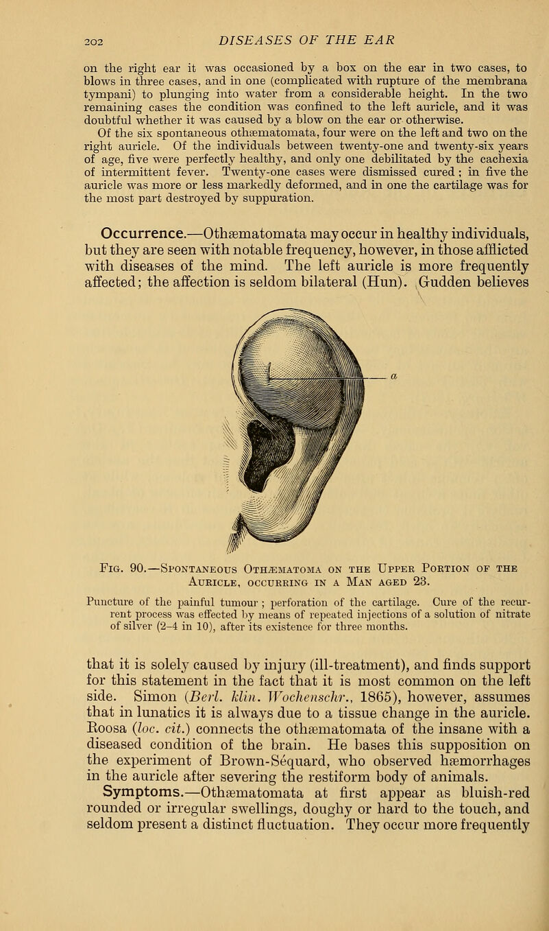 on the right ear it was occasioned by a bos on the ear in two cases, to blows in three cases, and in one (complicated with rupture of the rnembrana tympani) to plunging into water from a considerable height. In the two remaining cases the condition was confined to the left auricle, and it was doubtful whether it was caused by a blow on the ear or otherwise. Of the six spontaneous othaematomata, four were on the left and two on the right auricle. Of the individuals between twenty-one and twenty-six years of age, five were perfectly healthy, and only one debilitated by the cachexia of intermittent fever. Twenty-one cases were dismissed cured ; in five the auricle was more or less markedly deformed, and in one the cartilage was for the most part destroyed by suppuration. Occurrence.—Othaematomata may occur in healthy individuals, but they are seen with notable frequency, however, in those afflicted with diseases of the mind. The left auricle is more frequently affected; the affection is seldom bilateral (Hun). Gudden believes Fig. 90.—Spontaneous Othematoma on the Upper Portion of the Auricle, occurring in a Man aged 23. Puncture of the painful tumour ; perforation of the cartilage. Cure of the recur- rent process was effected by means of repeated injections of a solution of nitrate of silver (2-4 in 10), after its existence for three months. that it is solely caused by injury (ill-treatment), and finds support for this statement in the fact that it is most common on the left side. Simon (Berl. klin. Wochenschr., 1865), however, assumes that in lunatics it is always due to a tissue change in the auricle. Eoosa (loc. cit.) connects the othaematomata of the insane with a diseased condition of the brain. He bases this supposition on the experiment of Brown-Sequard, who observed haemorrhages in the auricle after severing the restiform body of animals. Symptoms.—Othaematomata at first appear as bluish-red rounded or irregular swellings, doughy or hard to the touch, and seldom present a distinct fluctuation. They occur more frequently