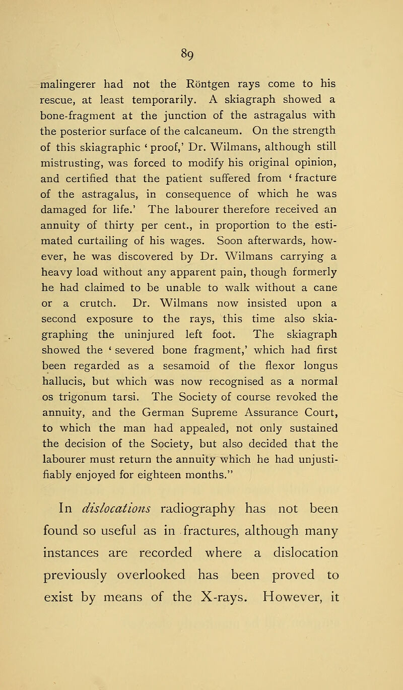 malingerer had not the Rontgen rays come to his rescue, at least temporarily. A skiagraph showed a bone-fragment at the junction of the astragalus with the posterior surface of the calcaneum. On the strength of this skiagraphic ' proof,' Dr. Wilmans, although still mistrusting, was forced to modify his original opinion, and certified that the patient suffered from ' fracture of the astragalus, in consequence of which he was damaged for life.' The labourer therefore received an annuity of thirty per cent., in proportion to the esti- mated curtailing of his wages. Soon afterwards, how- ever, he was discovered by Dr. Wilmans carrying a heavy load without any apparent pain, though formerly he had claimed to be unable to walk without a cane or a crutch. Dr. Wilmans now insisted upon a second exposure to the rays, this time also skia- graphing the uninjured left foot. The skiagraph showed the ' severed bone fragment,' which had first been regarded as a sesamoid of the flexor longus hallucis, but which was now recognised as a normal OS trigonum tarsi. The Society of course revoked the annuity, and the German Supreme Assurance Court, to which the man had appealed, not only sustained the decision of the Society, but also decided that the labourer must return the annuity which he had unjusti- fiably enjoyed for eighteen months. In dislocations radiography has not been found so useful as in fractures, although many instances are recorded where a dislocation previously overlooked has been proved to exist by means of the X-rays. However, it