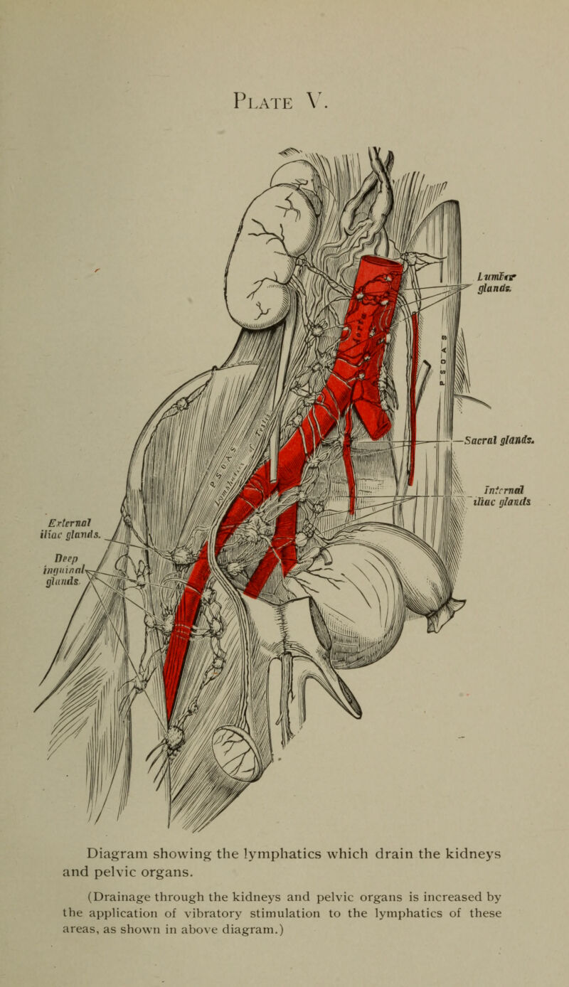 Plate V. Lvmttir glands. Sacral glands* \ Internal iliac glands Erternal iliac glands. Deep inijitinai glands Diagram showing the lymphatics which drain the kidneys and pelvic organs. (Drainage through the kidneys and pelvic organs is increased by the application of vibratory stimulation to the lymphatics of these