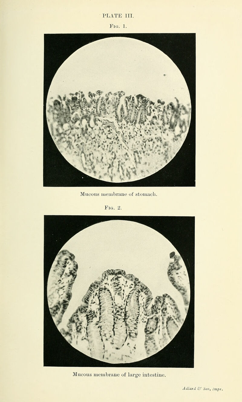 Miicous lueinbrane of stomach. Fig. 2. Mucous meiubrane of laro^e intestine.