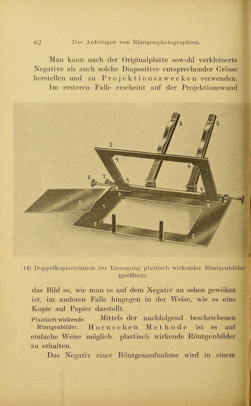 Man kann nach der Originalplatte sowohl verkleinerte Negative als auch solche Diapositive entsprechender Grösse herstellen und zu Projektionszwecken verwenden. Im ersteren Falle erscheint auf der Projektionswand (14) Doppelkopierrahmen zur Erzeugung plastisch wirkender Röntgenbilder (geöffnet). das Bild so, wie man es auf dem Negativ zu sehen gewöhnt ist, im anderen Falle hingegen in der Weise, wie es eine Kopie auf Papier darstellt. Plastisch wirkende Mittels der nachfolgend beschriebenen Röntgenbilder. Hornschen Methode ist es auf einfache Weise möglich, plastisch wirkende Röntgenbilder zu erhalten. Das Negativ einer Röntgenaufnahme wird in einem