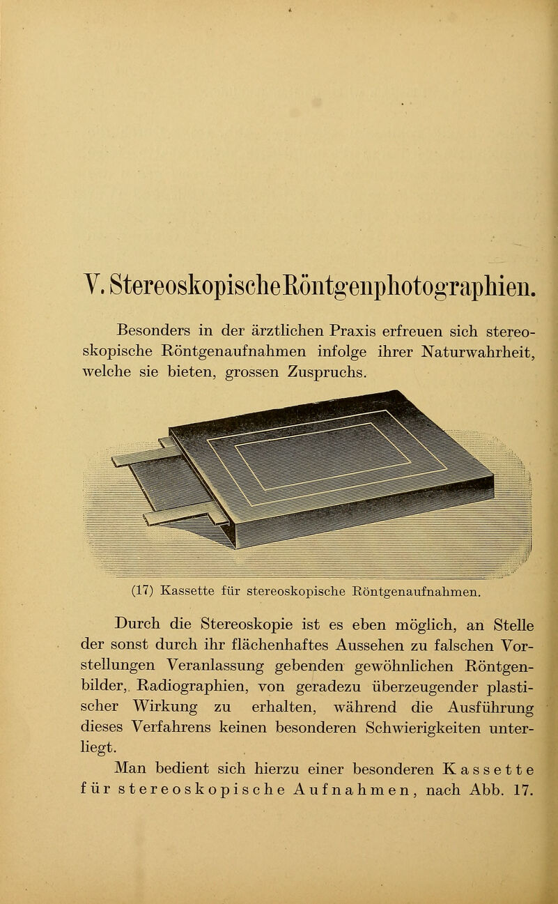 V.StereoskopischeßöntgenphotogTapMen. Besonders in der ärztlichen Praxis erfreuen sich stereo- skopische Röntgenaufnahmen infolge ihrer Naturwahrheit, welche sie bieten, grossen Zuspruchs. (17) Kassette für stereoskopische Röntgenaufnahmen. Durch die Stereoskopie ist es eben möglich, an Stelle der sonst durch ihr flächenhaftes Aussehen zu falschen Vor- stellungen Veranlassung gebenden gewöhnlichen Röntgen- bilder, Radiographien, von geradezu überzeugender plasti- scher Wirkung zu erhalten, während die Ausführung dieses Verfahrens keinen besonderen Schwierigkeiten unter- liegt. Man bedient sich hierzu einer besonderen Kassette für stereoskopische Aufnahmen, nach Abb. 17.