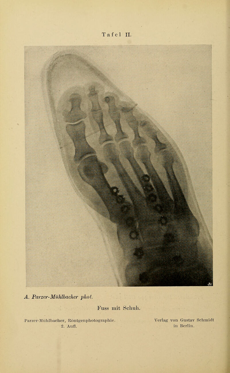 A. Parzer-Mühlbacher phot. Fuss mit Schuh. Parzer-Mühlbacher, Röntgenphotographie. Verlag von Gustav Schmidt