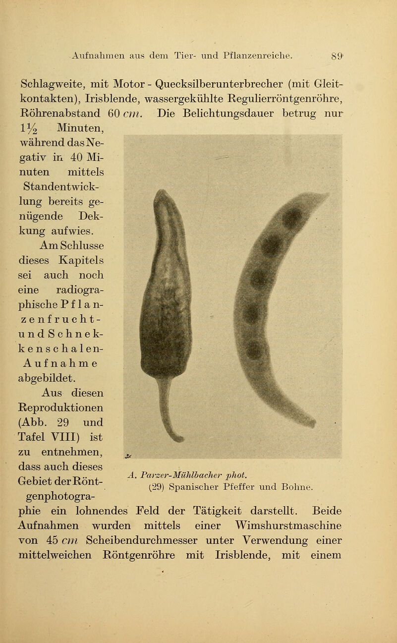 Schlagweite, mit Motor - Quecksilberunterbrecher (mit Gleit- kontakten), Irisblende, wassergekühlte Regulierröntgenröhre, Röhrenabstand 60 ein. Die Belichtungsdauer betrug nur 11/2 Minuten, während das Ne- /^, gativ in 40 Mi- nuten mittels Standentwick- lung bereits ge- nügende Dek- kung aufwies. Am Schlüsse dieses Kapitels sei auch noch eine radiogra- phische P f 1 a n- zenfrucht- undSchnek- kenschalen- Aufnahme abgebildet. Aus diesen Reproduktionen (Abb. 29 und Tafel VIII) ist zu entnehmen, dass auch dieses Gebiet derRönt- genphotogra- phie ein lohnendes Feld der Tätigkeit darstellt. Beide Aufnahmen wurden mittels einer Wimshurstmaschine von 45 cjii Scheibendurchmesser unter Verwendung einer mittelweichen Röntgenröhre mit Irisblende, mit einem A. Parzer-Mühlbacher phot. (29) Spanischer Pfeffer und Bolme.