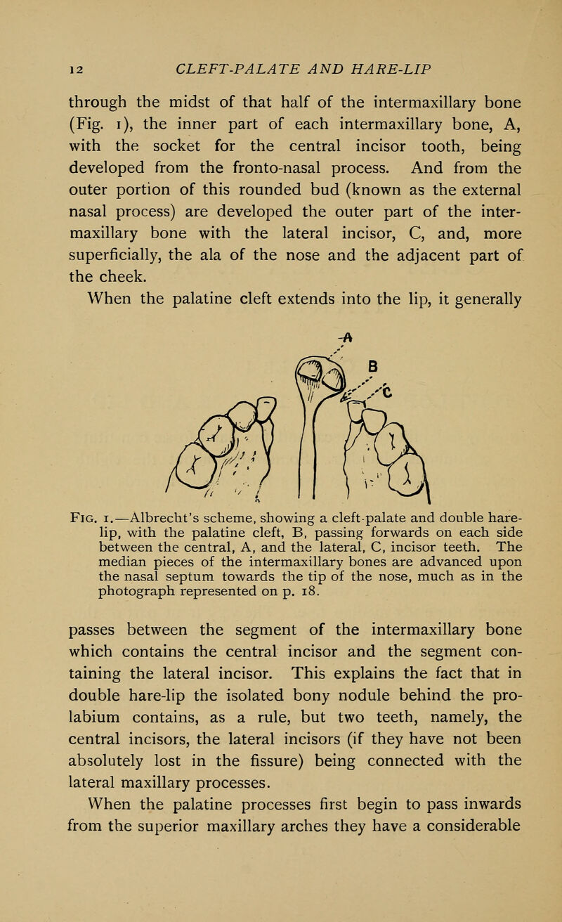 through the midst of that half of the intermaxillary bone (Fig. i), the inner part of each intermaxillary bone, A, with the socket for the central incisor tooth, being developed from the fronto-nasal process. And from the outer portion of this rounded bud (known as the external nasal process) are developed the outer part of the inter- maxillary bone with the lateral incisor, C, and, more superficially, the ala of the nose and the adjacent part of the cheek. When the palatine cleft extends into the lip, it generally -A Fig. i.—Albrecht's scheme, showing a cleft-palate and double hare- lip, with the palatine cleft, B, passing forwards on each side between the central, A, and the lateral, C, incisor teeth. The median pieces of the intermaxillary bones are advanced upon the nasal septum towards the tip of the nose, much as in the photograph represented on p. 18. passes between the segment of the intermaxillary bone which contains the central incisor and the segment con- taining the lateral incisor. This explains the fact that in double hare-lip the isolated bony nodule behind the pro- labium contains, as a rule, but two teeth, namely, the central incisors, the lateral incisors (if they have not been absolutely lost in the fissure) being connected with the lateral maxillary processes. When the palatine processes first begin to pass inwards from the superior maxillary arches they have a considerable