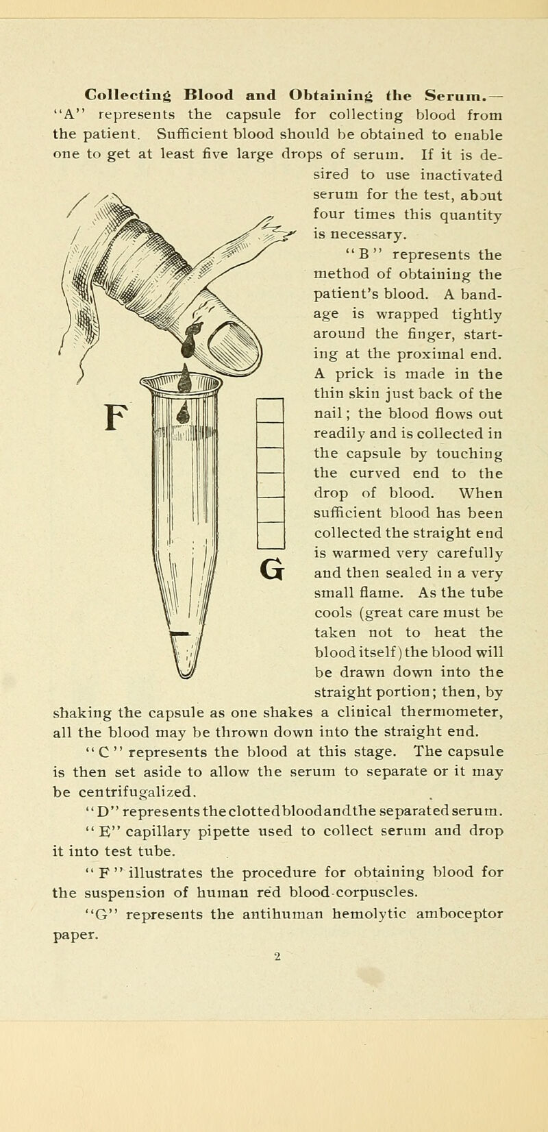 Collecting Blood and Obtaining the Serum.— A represents the capsule for collecting blood from the patient. Sufficient blood should be obtained to enable one to get at least five large drops of serum. If it is de- sired to use inactivated serum for the test, about four times this quantity is necessary. B represents the method of obtaining the patient's blood. A band- age is wrapped tightly around the finger, start- ing at the proximal end. A prick is made in the thin skin just back of the nail; the blood flows out readily and is collected in the capsule by touching the curved end to the drop of blood. When sufficient blood has been collected the straight end is warmed very carefully and then sealed in a very small flame. As the tube cools (great care must be taken not to heat the blood itself) the blood will be drawn down into the straight portion; then, by shaking the capsule as one shakes a clinical thermometer, all the blood may be thrown down into the straight end. C represents the blood at this stage. The capsule is then set aside to allow the serum to separate or it may be centrifugalized. D represents the clottedbloodandthe separated serum.  E capillary pipette used to collect serum and drop it into test tube. F illustrates the procedure for obtaining blood for the suspension of human red blood-corpuscles. G represents the antihuman hemolytic amboceptor paper.