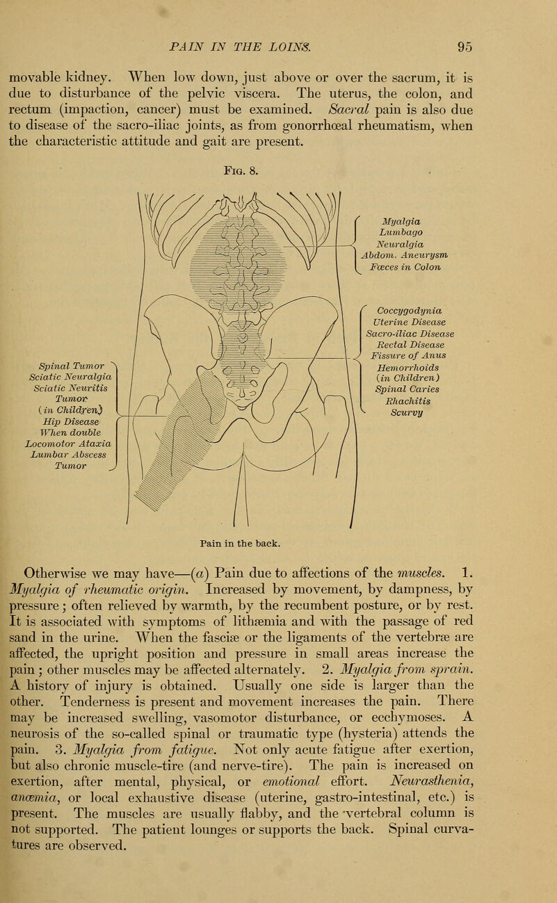 PAIN IN THE LOINS. movable kidney. When low down, just above or over the sacrum, it is due to disturbance of the pelvic viscera. The uterus, the colon, and rectum (impaction, cancer) must be examined. Sacral pain is also due to disease of the sacro-iliac joints, as from gonorrheal rheumatism, when the characteristic attitude and gait are present. Spinal Tumor ^ Sciatic Neuralgia Sciatic Neuritis Tumor- (in Children) Hip Disease When double Locomotor Ataxia Lumbar Abscess Tumor K Myalgia Lumbago Neuralgia Abdom. Aneurysm Faeces in Colon Coccygodynia Uterine Disease Sacro-iliac Disease Rectal Disease Fissure of Anus Hemorrhoids {in Children) Spinal Caries Rhachitis Scurvy Pain in the back. Otherwise we may have—(a) Pain due to affections of the muscles. 1. Myalgia of rheumatic origin. Increased by movement, by dampness, by pressure; often relieved by warmth, by the recumbent posture, or by rest. It is associated with symptoms of lithsemia and with the passage of red sand in the urine. When the fasciae or the ligaments of the vertebrae are affected, the upright position and pressure in small areas increase the pain ; other muscles may be affected alternately. 2. Myalgia from sprain. A history of injury is obtained. Usually one side is larger than the other. Tenderness is present and movement increases the pain. There may be increased swelling, vasomotor disturbance, or ecchymoses. A neurosis of the so-called spinal or traumatic type (hysteria) attends the pain. 3. Myalgia from fatigue. Not only acute fatigue after exertion, but also chronic muscle-tire (and nerve-tire). The pain is increased on exertion, after mental, physical, or emotional effort. Neurasthenia, anaemia, or local exhaustive disease (uterine, gastro-intestinal, etc.) is present. The muscles are usually flabby, and the 'vertebral column is not supported. The patient lounges or supports the back. Spinal curva- tures are observed.