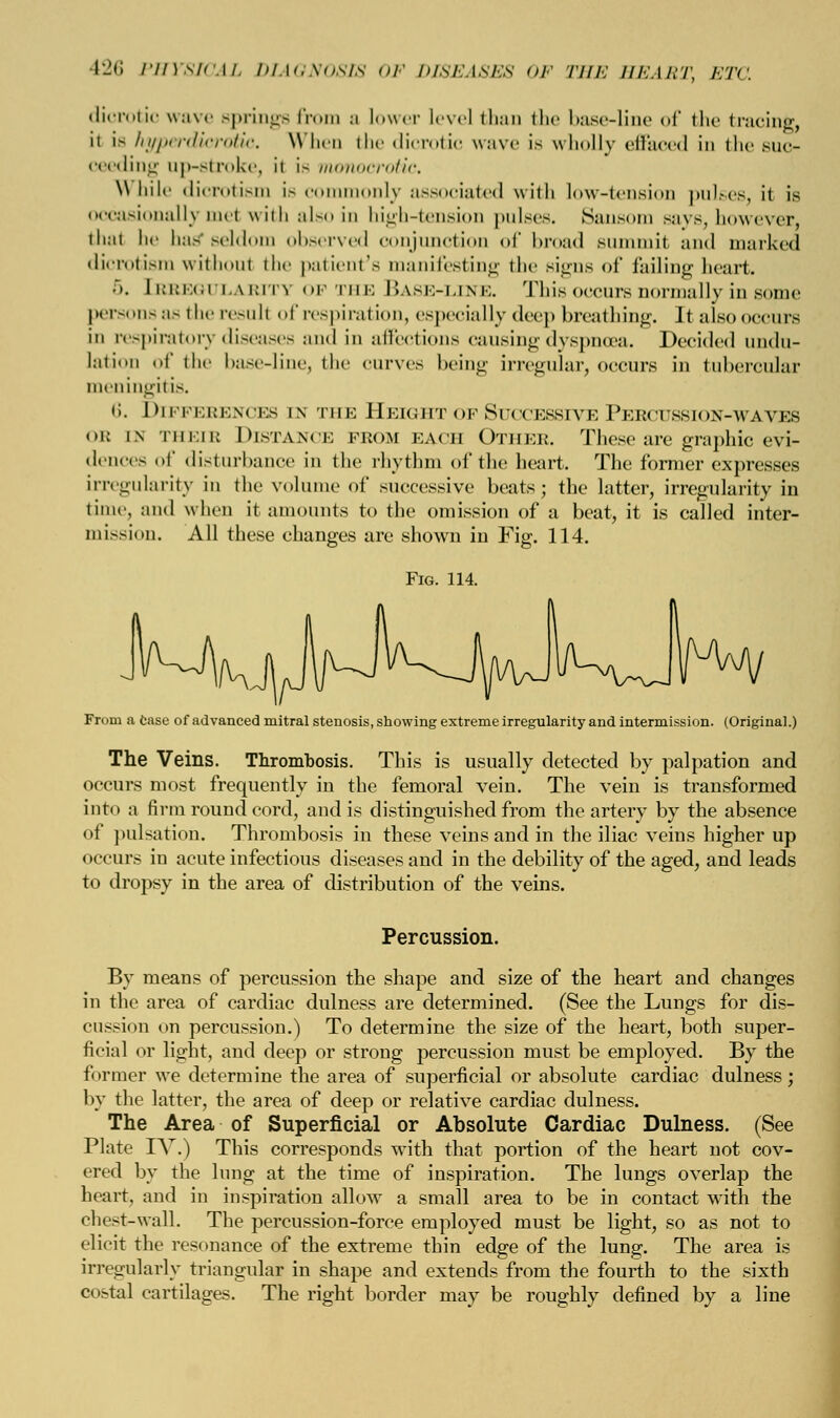 f the tracing, •d in the 8UC- dicrotic wave springe from a lower level than the base-line ii is hyperdicrotic. When the dicrotic wave is wholly effai ceeding up-stroke, it is monocrotic. \\ hile dicrotism is c monly associated with low-tension pulses, it is occasionally me< with also in high-tension pulses. Sausom says, however, thai he lias seldom observed conjunction of broad summit and marked dicrotism without the patient's manifesting the signs of failing heart. 5. Ii:i:k.i i \i:my op the Base-line. This occurs normally in some personsas theresull of respiration, especially deep breathing. Jt also occurs in respiratory diseases and in affections causing dyspnoea. Decided undu- lation of the base-line, the curves being irregular, occurs in tubercular meningitis. ii. Differences in the Height of Successive Pebcussion-wayes ob in their Distance from each Other. These are graphic evi- dences of disturbance in the rhythm of the heart. The former expresses irregularity in the volume of successive beats; the latter, irregularity in time, and when it amounts to the omission of a beat, it is called inter- mission. All these changes are shown in Fig. 114. Fig. 114. From a Case of advanced mitral stenosis, showing extreme irregularity and intermission. (Original.) The Veins. Thrombosis. This is usually detected by palpation and occurs most frequently in the femoral vein. The vein is transformed into a firm round cord, and is distinguished from the artery by the absence of pulsation. Thrombosis in these veins and in the iliac veins higher up occurs in acute infectious diseases and in the debility of the aged, and leads to dropsy in the area of distribution of the veins. Percussion. By means of percussion the shape and size of the heart and changes in the area of cardiac dulness are determined. (See the Lungs for dis- cussion on percussion.) To determine the size of the heart, both super- ficial or light, and deep or strong percussion must be employed. By the former we determine the area of superficial or absolute cardiac dulness; by the latter, the area of deep or relative cardiac dulness. The Area of Superficial or Absolute Cardiac Dulness. (See Plate IV.) This corresponds with that portion of the heart not cov- ered by the lung at the time of inspiration. The lungs overlap the heart, and in inspiration allow a small area to be in contact with the chest-wall. The percussion-force employed must be light, so as not to elicit the resonance of the extreme thin edge of the lung. The area is irregularly triangular in shape and extends from the fourth to the sixth costal cartilages. The right border may be roughly defined by a line