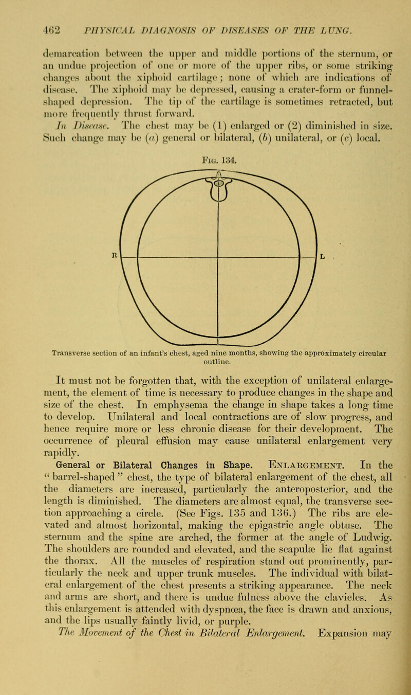 162 PHYSICAL DIAGNOSIS or insr.isrs or Tlir rr.xi;. demarcation between the upper and middle portions of the sternum, or an undue projection of one or more of the upper ribs, or sonic striking changes about the xiphoid cartilage; none of which arc indications of disease. The xiphoid may lie depressed, causing a cratcr-fonn or funnel- shaped depression. The tip of the cartilage is sometimes retracted, but more frequently thrust forward. //( Disease. The chest may be (1) enlarged or (2) diminished in size. Such change may be (a) general or bilateral, (6) unilateral, or (c) local. Fib. 134. Transverse section of an infant's chest, aged nine months, showing the approximately circular outline. It must not be forgotten that, with the exception of unilateral enlarge- ment, the element of time is necessary to produce changes in the shape and size of the chest. In emphysema the change in shape takes a long time to develop. Unilateral and local contractions are of slow progress, and hence require more or less chronic disease for their development. The occurrence of pleural effusion may cause unilateral enlargement very rapidly. General or Bilateral Changes in Shape. Enlargement. In the  barrel-shaped  chest, the type of bilateral enlargement of the chest, all the diameters are increased, particularly the anteroposterior, and the length is diminished. The diameters are almost equal, the transverse sec- tion approaching a circle. (See Figs. 135 and 136.) The ribs are ele- vated and almost horizontal, making the epigastric angle obtuse. The sternum and the spine are arched, the former at the angle of Ludwig. The shoulders are rounded and elevated, and the scapula? lie flat against the thorax. All the muscles of respiration stand out prominently, par- ticularly the neck and upper trunk muscles. The individual with bilat- eral enlargement of the chest presents a striking appearance. The neck and arms are short, and there is undue fulness above the clavicles. As this enlargement is attended with dyspnoea, the face is drawn and anxious, and the lips usually faintly livid, or purple. The Movement of the Chest in Bilateral Enlargement. Expansion may