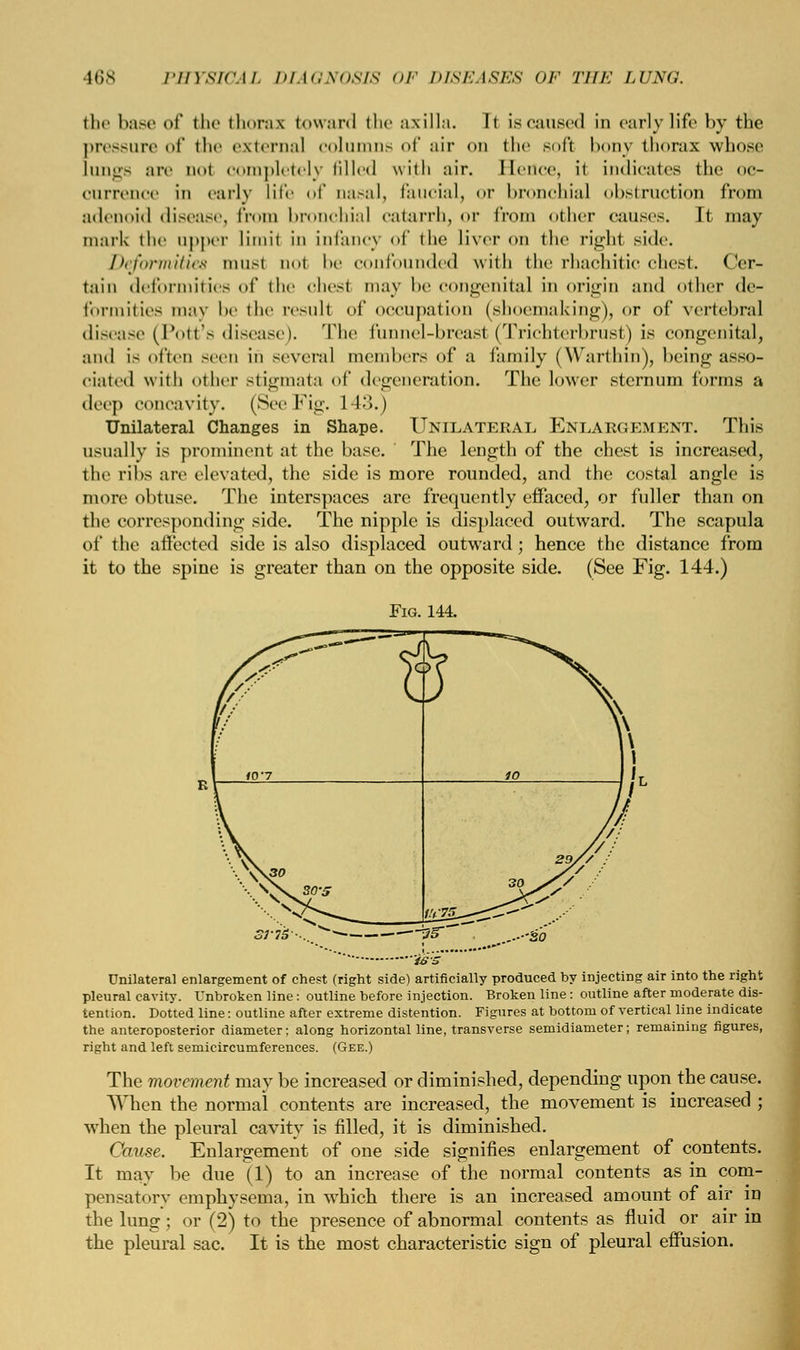 the base of the thorax toward the axilla. It is caused in early life by the pressure of the external columns of air <>n the soft bony thorax whose Lungs are uoi completely filled with air. Hence, it indicates the oc- currence in .arly life of na.-al, faucial, or bronchial obstruction from adenoid disease, from bronchial catarrh, or from other causes. It may mark the upper limit in infancy of the liver on the right side. Deformities must not be confounded with the rhachitic chest. Cer- tain deformities of the chest may be congenital in origin and other de- formities may be the result of occupation (shoemaking), or of vertebral disease (Pott's disease). The funnel-breast (Trichterbrust) is congenital, and is often -c<n in several members of a family (Warthin), being asso- ciated with other stigmata <>(' degeneration. The lower sternum forms a deep concavity. (SeeFig. 1 13.) Unilateral Changes in Shape. Unilateral ENLARGEMENT. This usually is prominent at the base. The length of the chest is increased, the ribs are elevated, the side is more rounded, and the costal angle is more obtuse. The interspaces are frequently effaced, or fuller than on the corresponding side. The nipple is displaced outward. The scapula of the affected side is also displaced outward; hence the distance from it to the spine is greater than on the opposite side. (See Fig. 144.) Fig. 144. SJ7S ies Unilateral enlargement of chest (right side) artificially produced by injecting air into the right pleural cavity. Unbroken line: outline before injection. Broken line: outline after moderate dis- tention. Dotted line: outline after extreme distention. Figures at bottom of vertical line indicate the anteroposterior diameter; along horizontal line, transverse semidiameter; remaining figures, right and left semicircumferences. (Gee.) The movement may be increased or diminished, depending upon the cause. When the normal contents are increased, the movement is increased ; when the pleural cavity is filled, it is diminished. Cause. Enlargement of one side signifies enlargement of contents. It may be due (1) to an increase of the normal contents as in com- pensatory emphysema, in which there is an increased amount of air in the lung; or (2) to the presence of abnormal contents as fluid or air in the pleural sac. It is the most characteristic sign of pleural effusion.