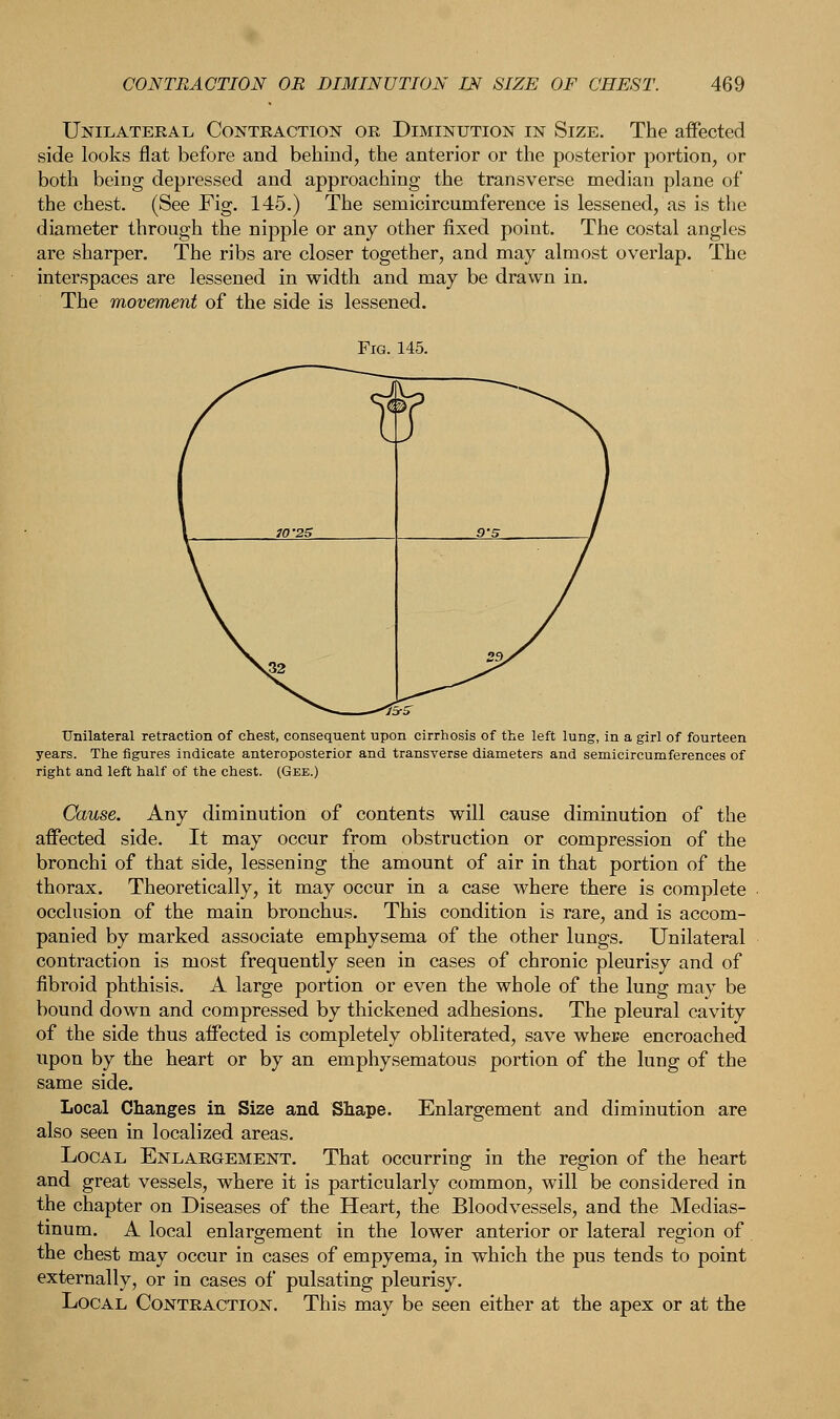 Unilateral Contraction or Diminution in Size. The affected side looks flat before and behind, the anterior or the posterior portion, or both being depressed and approaching the transverse median plane of the chest. (See Fig. 145.) The semicircumference is lessened, as is the diameter through the nipple or any other fixed point. The costal angles are sharper. The ribs are closer together, and may almost overlap. The interspaces are lessened in width and may be drawn in. The movement of the side is lessened. Fig. 145. Unilateral retraction of chest, consequent upon cirrhosis of the left lung, i years. The figures indicate anteroposterior and transverse diameters and sen right and left half of the chest. (Gee.) a girl of fourteen urcumferences of Cause. Any diminution of contents will cause diminution of the affected side. It may occur from obstruction or compression of the bronchi of that side, lessening the amount of air in that portion of the thorax. Theoretically, it may occur in a case where there is complete occlusion of the main bronchus. This condition is rare, and is accom- panied by marked associate emphysema of the other lungs. Unilateral contraction is most frequently seen in cases of chronic pleurisy and of fibroid phthisis. A large portion or even the whole of the lung may be bound down and compressed by thickened adhesions. The pleural cavity of the side thus affected is completely obliterated, save where encroached upon by the heart or by an emphysematous portion of the lung of the same side. Local Changes in Size and Shape. Enlargement and diminution are also seen in localized areas. Local Enlargement. That occurring in the region of the heart and great vessels, where it is particularly common, will be considered in the chapter on Diseases of the Heart, the Bloodvessels, and the Medias- tinum. A local enlargement in the lower anterior or lateral region of the chest may occur in cases of empyema, in which the pus tends to point externally, or in cases of pulsating pleurisy. Local Contraction. This may be seen either at the apex or at the