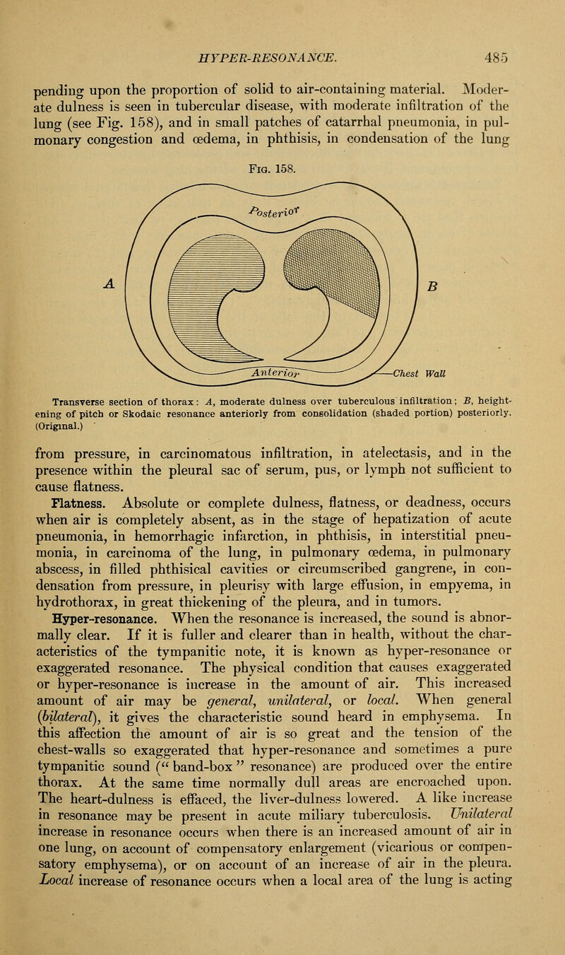 pending upon the proportion of solid to air-containing material. Moder- ate dulness is seen in tubercular disease, with moderate infiltration of the lung (see Fig. 158), and in small patches of catarrhal pneumonia, in pul- monary congestion and oedema, in phthisis, in condensation of the lung Transverse section of thorax: A, moderate dulness over tuberculous infiltration; B, height- ening of pitch or Skodaic resonance anteriorly from consolidation (shaded portion) posteriorly. (Original.) from pressure, in carcinomatous infiltration, in atelectasis, and in the presence within the pleural sac of serum, pus, or lymph not sufficient to cause flatness. Flatness. Absolute or complete dulness, flatness, or deadness, occurs when air is completely absent, as in the stage of hepatization of acute pneumonia, in hemorrhagic infarction, in phthisis, in interstitial pneu- monia, in carcinoma of the lung, in pulmonary oedema, in pulmonary abscess, in filled phthisical cavities or circumscribed gangrene, in con- densation from pressure, in pleurisy with large effusion, in empyema, in hydrothorax, in great thickening of the pleura, and in tumors. Hyper-resonance. When the resonance is increased, the sound is abnor- mally clear. If it is fuller and clearer than in health, without the char- acteristics of the tympanitic note, it is known as hyper-resonance or exaggerated resonance. The physical condition that causes exaggerated or hyper-resonance is increase in the amount of air. This increased amount of air may be general, unilateral, or local. When general (bilateral), it gives the characteristic sound heard in emphysema. In this affection the amount of air is so great and the tension of the chest-walls so exaggerated that hyper-resonance and sometimes a pure tympanitic sound ( band-box  resonance) are produced over the entire thorax. At the same time normally dull areas are encroached upon. The heart-dulness is effaced, the liver-dulness lowered. A like increase in resonance may be present in acute miliary tuberculosis. Unilateral increase in resonance occurs when there is an increased amount of air in one lung, on account of compensatory enlargement (vicarious or compen- satory emphysema), or on account of an increase of air in the pleura. Local increase of resonance occurs when a local area of the lung is acting