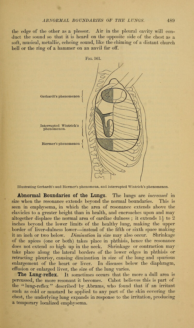 the edge of the other as a plessor. Air in the pleural cavity will con- duct the sound so that it is heard on the opposite side of the chest as a soft, musical, metallic, echoing sound, like the chiming of a distant church bell or the ring of a hammer on an anvil far off. Gerhardt's phenomenon Biermer's phenomenon Illustrating Gerhardt's and Biermer's phenomena, and interrupted Wintrich's phenomenon. Abnormal Boundaries of the Lungs. The lungs are increc size when the resonance extends beyond the normal boundaries. This is seen in emphysema, in which the area of resonance extends above the clavicles to a greater height than in health, and encroaches upon and may altogether displace the normal area of cardiac dulness ; it extends 1^- to 2 inches beyond the lower limits of the healthy lung, making the upper border of liver-dulness lower—instead of the fifth or sixth space making it an inch or two below. Diminution in size may also occur. Shrinkage of the apices (one or both) takes place in phthisis, hence the resonance does not extend so high up in the neck. Shrinkage or contraction may take place along the lateral borders of the lower edges in phthisis or retracting pleurisy, causing diminution in size of the lung and spurious enlargement of the heart or liver. In diseases below the diaphragm, effusion or enlarged liver, the size of the lung varies. The Lung-reflex. It sometimes occurs that the more a dull area is percussed, the more resonant it becomes. Cabot believes this is part of the  lung-reflex described by Abrams, who found that if an irritaDt such as cold or mustard be applied to any part of the skin covering the chest, the underlying lung expands in response to the irritation, producing a temporary localized emphysema.