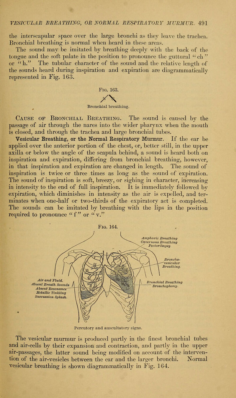 the interscapular space over the large bronchi as they leave the trachea. Bronchial breathing is normal when heard in these areas. The sound may be imitated by breathing deeply with the back of the tongue and the soft palate in the position to pronounce the guttural  ch  or  h. The tubular character of the sound and the relative length of the sounds heard during inspiration and expiration are diagrammatically represented in Fig. 163. Ftg. 163. XX Bronchial breathing. Cause of Bronchial Breathing. The sound is caused by the passage of air through the nares into the wider pharynx when the mouth is closed, and through the trachea and large bronchial tubes. Vesicular Breathing, or the Normal Respiratory Murmur. If the ear be applied over the anterior portion of the chest, or, better still, in the upper axilla or below the angle of the scapula behind, a sound is heard both on inspiration and expiration, differing from bronchial breathing, however, in that inspiration and expiration are changed in length. The sound of inspiration is twice or three times as long as the sound of expiration. The sound of inspiration is soft, breezy, or sighing in character, increasing in intensity to the end of full inspiration. It is immediately followed by expiration, which diminishes in intensity as the air is expelled, and ter- minates when one-half or two-thirds of the expiratory act is completed. The sounds can be imitated by breathing with the lips in the position required to pronounce  f  or  v. Fig. 164. Amphoric Breathing Cavernous Breathing ' Pectoriloquy- Air and Uluid. Absent Breath Sounds Absent Besonance' Metallic Tinkling Succussion Splash. Percutory and auscultatory signs. The vesicular murmur is produced partly in the finest bronchial tubes and air-cells by their expansion and contraction, and partly in the upper air-passages, the latter sound being modified on account of the interven- tion of the air-vesicles between the ear and the larger bronchi. Normal vesicular breathing is shown diagrammatically in Fig. 164.