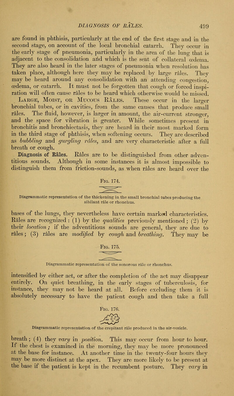 are found in phthisis, particularly at the end of the first stage and in the second stage, on account of the local bronchial catarrh. They occur in the early stage of pneumonia, particularly in the area of the lung that is adjacent to the consolidation arid which is the seat of collateral oedema. They are also heard in the later stages of pneumonia when resolution has taken place, although here they may be replaced by large rales. They may be heard around any consolidation with an attending congestion, oedema, or catarrh. It must not be forgotten that cough or forced inspi- ration will often cause rales to be heard which otherwise would be missed. Large, Moist, or Mucous Bales. These occur in the larger bronchial tubes, or in cavities, from the same causes that produce small rales. The fluid, however, is larger in amount, the air-current stronger, and the space for vibration is greater. While sometimes present in bronchitis and bronchiectasis, they are heard in their most marked form in the third stage of phthisis, when softening occurs. They are described as bubbling and gurgling rales, and are very characteristic after a full breath or cough. Diagnosis of Rales. Kales are to be distinguished from other adven- titious sounds. Although in some instances it is almost impossible to distinguish them from friction-sounds, as when rales are heard over the Fig. 174. Diagrammatic representation of the thickening in the small bronchial tubes producing the sibilant rale or rhonchus. bases of the lungs, they nevertheless have certain marked characteristics. Rales are recognized : (1) by the qualities previously mentioned; (2) by their location; if the adventitious sounds are general, they are due to rales; (3) rales are modified by cough and breathing. They may be Diagrammatic representation of the sonorous rale or rhonchus. intensified by either act, or after the completion of the act may disappear entirely. On quiet breathing, in the early stages of tuberculosis, for instance, they may not be heard at all. Before excluding them it is absolutely necessary to have the patient cough and then take a full Diagrammatic representation of the crepitant rale produced in the air-vesicle. breath ; (4) they vary in position. This may occur from hour to hour. If the chest is examined in the morning, they may be more pronounced at the base for instance. At another time in the twenty-four hours they may be more distinct at the apex. They are more likely to be present at the base if the patient is kept in the recumbent posture. They vary in