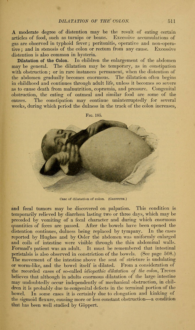 A moderate degree of distention may be the result of eating certain articles of food, such as turnips or beans. Excessive accumulations of gas are observed in typhoid fever; peritonitis, operative and non-opera- tive ; and in stenosis of the colon or rectum from any cause. Excessive distention is also common in hysteria. Dilatation of the Colon. In children the enlargement of the abdomen may be general. The dilatation may be temporary, as in constipation with obstruction; or in rare instances permanent, when the distention of the abdomen gradually becomes enormous. The dilatation often begins in childhood and continues through adult life, unless it becomes so severe as to cause death from malnutrition, coprsemia, and pressure. Congenital obstruction, the eating of oatmeal and similar food are some of the causes. The constipation may continue uninterruptedly for several weeks, during which period the dulness in the track of the colon increases, Fig. 185. Case of dilatation of colon. (Griffith.) and fecal tumors may be discovered on palpation. This condition is temporarily relieved by diarrhoea lasting two or three days, which may be preceded by vomiting of a fecal character and during which enormous quantities of feces are passed. After the bowels have been opened the distention continues, dulness being replaced by tympany. In the cases reported by Hughes and by Osier the abdomen was uniformly enlarged and coils of intestine were visible through the thin abdominal walls. Formad's patient was an adult. It must be remembered that intestinal peristalsis is also observed in constriction of the bowels. (See page 508.) The movement of the intestine above the seat of stricture is undulating or worm-like, and the bowel itself is dilated. From a consideration of the recorded cases of so-called idiopathic dilatation of the colon, Treves believes that although in adults enormous dilatation of the large intestine may undoubtedly occur independently of mechanical obstruction, in chil- dren it is probably due to congenital defects in the terminal portion of the bowel. In some cases it is certainly due to elongation and kinking of the sigmoid flexure, causing more or less constant obstruction—a condition that has been well studied by G5ppert.