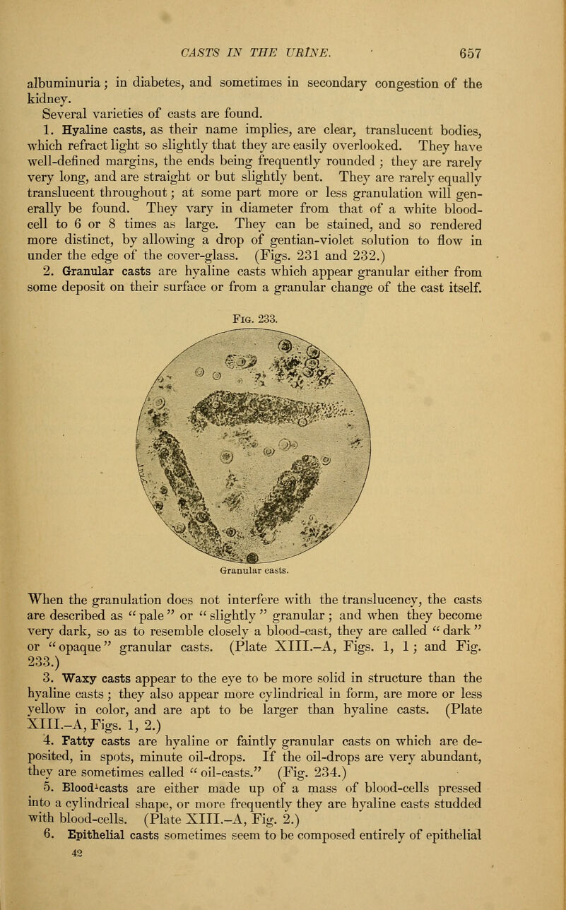 albuminuria; in diabetes, and sometimes in secondary congestion of the kidney. Several varieties of casts are found. 1. Hyaline casts, as their name implies, are clear, translucent bodies, which refract light so slightly that they are easily overlooked. They have well-defined margins, the ends being frequently rounded ; they are rarely very long, and are straight or but slightly bent. They are rarely equally translucent throughout; at some part more or less granulation will gen- erally be found. They vary in diameter from that of a white blood- cell to 6 or 8 times as large. They can be stained, and so rendered more distinct, by allowing a drop of gentian-violet solution to flow in under the edge of the cover-glass. (Figs. 231 and 232.) 2. Granular casts are hyaline casts which appear granular either from some deposit on their surface or from a granular change of the cast itself. When the granulation does not interfere with the translucency, the casts are described as  pale  or  slightly  granular ; and when they become very dark, so as to resemble closely a blood-cast, they are called dark or  opaque granular casts. (Plate XIII.-A, Figs. 1, 1; and Fig. 233.) 3. Waxy casts appear to the eye to be more solid in structure than the hyaline casts ; they also appear more cylindrical in form, are more or less yellow in color, and are apt to be larger than hyaline casts. (Plate XIII.-A, Figs. 1, 2.) 4. Fatty casts are hyaline or faintly granular casts on which are de- posited, in spots, minute oil-drops. If the oil-drops are very abundant, they are sometimes called  oil-casts. (Fig. 234.) 5. BloodA casts are either made up of a mass of blood-cells pressed into a cylindrical shape, or more frequently they are hyaline casts studded with blood-cells. (Plate XIII.-A, Fig. 2.) 6. Epithelial casts sometimes seem to be composed entirely of epithelial