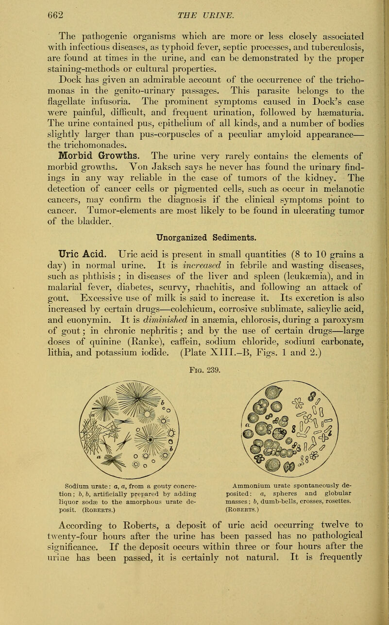 The pathogenic organisms which are more or less closely associated with infectious diseases, as typhoid fever, septic processes, and tuberculosis, are found at times in the urine, and can be demonstrated by the proper stainiug-methods or cultural properties. Dock has given an admirable account of the occurrence of the tricho- monas in the genito-urinary passages. This parasite belongs to the flagellate infusoria. The prominent symptoms caused in Dock's case were painful, difficult, and frequent urination, followed by hsematuria. The urine contained pus, epithelium of all kinds, and a number of bodies slightly larger than pus-corpuscles of a peculiar amyloid appearance— the trichomonades. Morbid Growths. The urine very rarely contains the elements of morbid growths. Von Jaksch says he never has found the urinary find- ings in any way reliable in the case of tumors of the kidney. The detection of cancer cells or pigmented cells, such as occur in melanotic cancers, may confirm the diagnosis if the clinical symptoms point to cancer. Tumor-elements are most likely to be found in ulcerating tumor of the bladder. Unorganized Sediments. Uric Acid. Uric acid is present in small quantities (8 to 10 grains a day) in normal urine. It is increased in febrile and wasting diseases, such as phthisis ; in diseases of the liver and spleen (leukaemia), and in malarial fever, diabetes, scurvy, rhachitis, and following an attack of gout. Excessive use of milk is said to increase it. Its excretion is also increased by certain drugs—colchicum, corrosive sublimate, salicylic acid, and euonymin. It is diminished in anaemia, chlorosis, during a paroxysm of gout; in chronic nephritis; and by the use of certain drugs—large doses of quinine (Ranke), caifein, sodium chloride, sodium carbonate, lithia, and potassium iodide. (Plate XIII.-B, Figs. 1 and 2.) Sodium urate: a, a, from a gouty concre- tion ; 6, 6, artificially prepared by adding liquor sodse to the amorphous urate de- posit. (Roberts.) Ammonium urate spontaneously de- posited: a, spheres and globular masses; b, dumb-bells, crosses, rosettes. (Roberts.) According to Roberts, a deposit of uric acid occurring twelve to twenty-four hours after the urine has been passed has no pathological significance. If the deposit occurs within three or four hours after the urine has been passed, it is certainly not natural. It is frequently