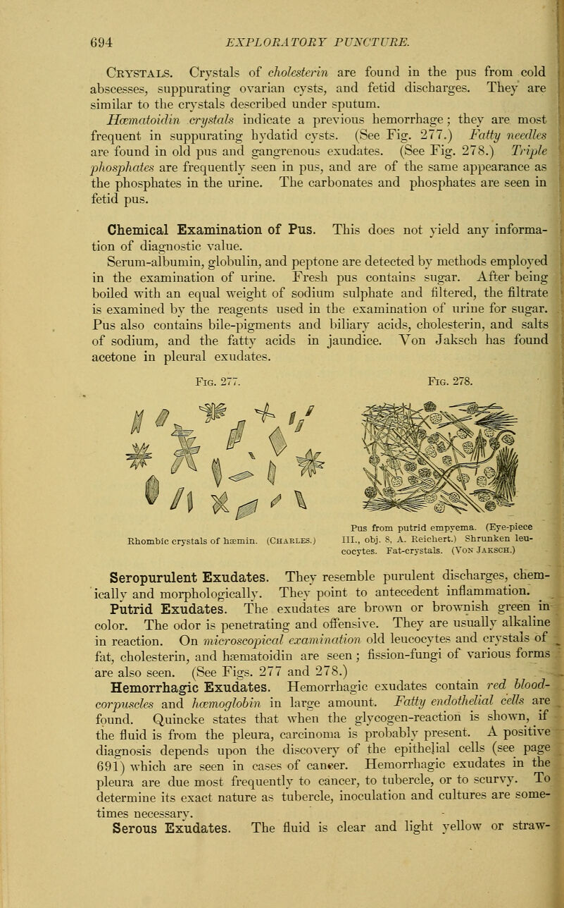 Crystals. Crystals of cholesterin are found in the pus from cold abscesses, suppurating ovarian cysts, and fetid discharges. They are similar to the crystals described under sputum. Hcematoidin crystals indicate a previous hemorrhage ; they are most frequent in suppurating hydatid cysts. (See Fig. 277.) Fatty needles are found in old pus and gangrenous exudates. (See Fig. 278.) Triple phosphates are frequently seen in pus, and are of the same appearance as the phosphates in the urine. The carbonates and phosphates are seen in fetid pus. Chemical Examination of Pus. This does not yield any informa- tion of diagnostic value. Serum-albumin, globulin, and peptone are detected by methods employed in the examination of urine. Fresh pus contains sugar. After being boiled with an equal weight of sodium sulphate and filtered, the filtrate is examined by the reagents used in the examination of urine for sugar. Pus also contains bile-pigments and biliary acids, cholesterin, and salts of sodium, and the fatty acids in jaundice. Yon Jaksch has found acetone in pleural exudates. Fig. 277. Fig. 278. Rhombic crystals of hsemii Pus from putrid empyema. (Eye-piece (Charles.) III., obj. 8, A. Reichert.) Shrunken leu- cocytes. Fat-crystals. (Von Jaksch.) Seropurulent Exudates. They resemble purulent discharges, chem- ically and morphologically. They point to antecedent inflammation. Putrid Exudates. The exudates are brown or brownish green' in color. The odor is penetrating and offensive. They are usually alkaline in reaction. On microscopical examination old leucocytes and crystals of fat, cholesterin, and bematoidin are seen; fission-fungi of various forms are also seen. (See Figs. 277 and 278.) Hemorrhagic Exudates. Hemorrhagic exudates contain red blood- corpuscles and haemoglobin in large amount, Fatty endothelial cells are found. Quincke states that when the glycogen-reaction is shown, ^ if the fluid is from the pleura, carcinoma is probably present. A positive diagnosis depends upon the discovery of the epithelial cells (see page 691) which are seen in cases of cancer. Hemorrhagic exudates in the pleura are due most frequently to cancer, to tubercle, or to scurvy. To determine its exact nature as tubercle, inoculation and cultures are some- times necessary. Serous Exudates. The fluid is clear and light yellow or straw-