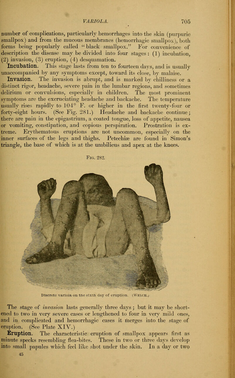 number of complications, particularly hemorrhages into the skin (purpuric smallpox) and from the mucous membranes (hemorrhagic smallpox), both forms being popularly called  black smallpox. For convenience of description the disease may be divided into four stages : (1) incubation, (2) invasion, (3) eruption, (4) desquamation. Incubation. This stage lasts from ten to fourteen days, and is usually unaccompanied by any symptoms except, toward its close, by malaise. Invasion. The invasion is abrupt, and is marked by chilliness or a distinct rigor, headache, severe pain in the lumbar regions, and sometimes delirium or convulsions, especially in children. The most prominent symptoms are the excruciating headache and backache. The temperature usually rises rapidly to 104° F. or higher in the first twenty-four or forty-eight hours. (See Fig. 281.) Headache and backache continue; there are pain in the epigastrium, a coated tongue, loss of appetite, nausea or vomiting, constipation, and copious perspiration. Prostration is ex- treme. Erythematous eruptions are not uncommon, especially on the inner surfaces of the legs and thighs. Petechia? are found in Simon's triangle, the base of which is at the umbilicus and apex at the knees. Discrete variola on tne The stage of invasion lasts generally three days; but it may be short- ened to two in very severe cases or lengthened to four in very mild ones, and in complicated and hemorrhagic cases it merges into the stage of eruption. (See Plate XIV.) Eruption. The characteristic eruption of smallpox appears first as minute specks resembling flea-bites. These in two or three days develop into small papules which feel like shot under the skin. In a day or two