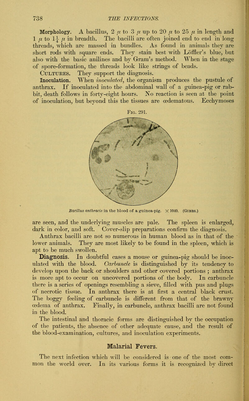 Morphology. A bacillus, 2 fi to 3 [i up to 20 p. to 25 p. in length and 1 p to 1^- p in breadth. The bacilli are often joined end to end in long threads, which are massed in bundles. As found in animals they are short rods with square ends. They stain best with Loffler's blue, but also with the basic anilines and by Gram's method. When in the stage of spore-formation, the threads look like strings of beads. Cultures. They support the diagnosis. Inoculation. When inoculated, the organism produces the pustule of anthrax. If inoculated into the abdominal wall of a guinea-pig or rab- bit, death follows in forty-eight hours. No reaction is seen at the point of inoculation, but beyond this the tissues are cedematous. Ecchymoses Bacillus anthracis in the blood of a guinea-pig. X 1040. (Gibbs.) are seen, and the underlying muscles are pale. The spleen is enlarged, dark in color, and soft. Cover-slip preparations confirm the diagnosis. Anthrax bacilli are not so numerous in human blood as in that of the lower animals. They are most likely to be found in the spleen, which is apt to be much swollen. Diagnosis. In doubtful cases a mouse or guinea-pig should be inoc- ulated with the blood. Carbuncle is distinguished by its tendency to develop upon the back or shoulders and other covered portions ; anthrax is more apt to occur on uncovered portions of the body. In carbuncle there is a series of openings resembling a sieve, filled with pus and plugs of necrotic tissue. In anthrax there is at first a central black crust. The boggy feeling of carbuncle is different from that of the brawny oedema of anthrax. Finally, in carbuncle, anthrax bacilli are not found in the blood. The intestinal and thoracic forms are distinguished by the occupation of the patients, the absence of other adequate cause, and the result of the blood-examination, cultures, and inoculation experiments. Malarial Fevers. The next infection which will be considered is one of the most com- mon the world over. In its various forms it is recognized by direct