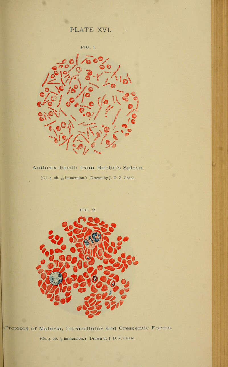 PLATE XVI. -j? of/feeV ^&o sW go ,' Anthrax-bacilli from Rabbit's Spleen. (Oc. 4, ob. jV immersion.) Drawn by J. D. Z. Chase. Protozoa of Malaria, Intracellular and Crescentie Forms.