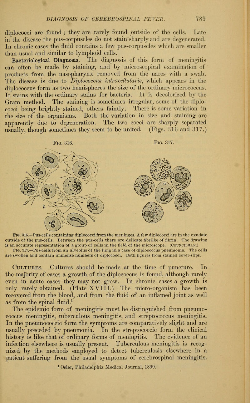 diplococci are found ; they are rarely found outside of the cells. Late in the disease the pus-corpuscles do not stain sharply and arc degenerated. In chronic cases the fluid contains a few pus-corpuscles which arc smaller than usual and similar to lymphoid cells. Bacteriological Diagnosis. The diagnosis of this form of meningitis can often be made by staining, and by microscopical examination of products from the nasopharynx removed from the nares with a swab. The disease is due to Diplococcus intracellular is, which appears in the diplococcus form as two hemispheres the size of the ordinary micrococcus. It stains with the ordinary stains for bacteria. It is decolorized by the Gram method. The staining is sometimes irregular, some of the diplo- cocci being brightly stained, others faintly. There is some variation in the size of the organisms. Both the variation in size and staining are apparently due to degeneration. The two cocci are sharply separated usually, though sometimes they seem to be united (Figs. 316 and 317.) 0ih ., Fig. 316.—Pus-cells containing diplococci from the meninges. A few diplococci are in the exudate outside of the pus-cells. Between the pus-cells there are delicate fibrillse of fibrin. The drawing is an accurate representation of a group of cells in the field of the microscope. (Councilman.) Fig. 317.—Pus-cells from an alveolus of the lung in a case of diplococcus pneumonia. The cells are swollen and contain immense numbers of diplococci. Both figures from stained cover-slips. Cultures. Cultures should be made at the time of puncture. In the majority of cases a growth of the diplococcus is found, although rarely even in acute cases they may not grow. In chronic cases a growth is only rarely obtained. (Plate XVIII.) The micro-organism has been recovered from the blood, and from the fluid of an inflamed joint as well as from the spinal fluid.1 The epidemic form of meningitis must be distinguished from pneumo- coccus meningitis, tuberculous meningitis, and streptococcus meningitis. In the pneumococcic form the symptoms are comparatively slight and are usually preceded by pneumonia. In the streptococcic form the clinical history is like that of ordinary forms of meningitis. The evidence of an infection elsewhere is usually present. Tuberculous meningitis is recog- nized by the methods employed to detect tuberculosis elsewhere in a patient suffering from the usual symptoms of cerebrospinal meningitis. 1 Osier, Philadelphia Medical Journal, 1899.