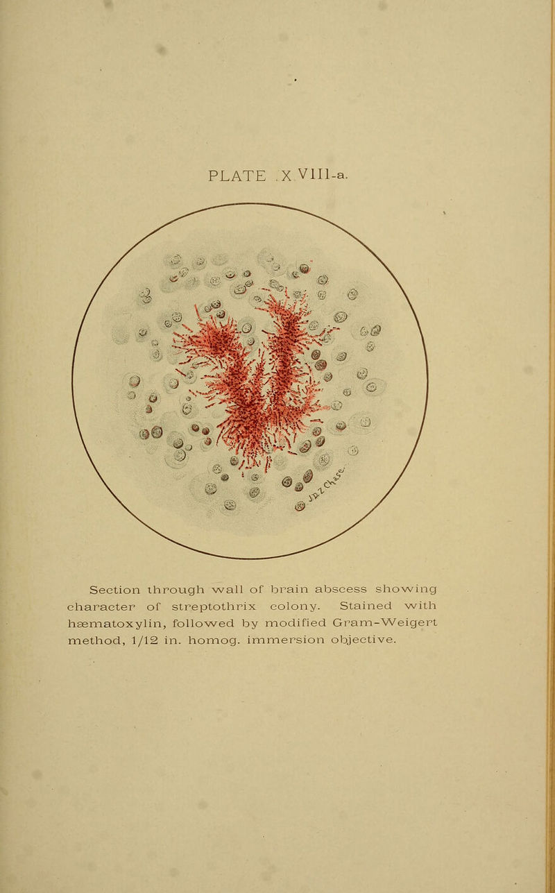 PLATE .X.VlIl-a. Section through wall of brain abscess showing character of streptothrix colony. Stained with hsematoxylin, followed by modified Gram-Weigert method, 1/12 in. homog. immersion objective.