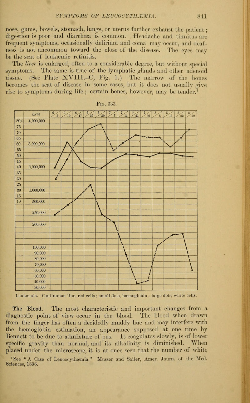 SYMPTOMS OF LEUCOCYTILEMIA. <S41 nose, gums, bowels, stomach, lungs, or uterus further exhaust the patient; digestion is poor and diarrhoea is common. Headache and tinnitus are frequent symptoms, occasionally delirium and coma may occur, and deaf- ness is not uncommon toward the close of the disease. The eyes may be the seat of leuksemic retinitis. The liver is enlarged, often to a considerable degree, but without special symptoms. The same is true of the lymphatic glands and other adenoid tissue. (See Plate XYIII.-C, Fig. 1.) The marrow of the bones becomes the seat of disease in some cases, but it does not usually give rise to symptoms during life; certain bones, however, may be tender.1 Fig. 333. DATE 6 y <; 6 _ 6/ r, ;-' 7/ / 1 7/ 7 ,- 7 S / Hi /■ :a « ,1 4.000,000 75 ,»' '\ 70 ,'*' ' 65 / ~S*^ — ... —-\ y 60 3.000,000 ^ \ y 55 V 50 / 45 / 40 2,000,000 / 35 30 .' 25 A 20 1,000,000 '\ 15 / \ 10 500,000 • X \ s \ 250,000 s \ 200,000 \ \ \ .~ \ \ , \ 100,000 \ r i 90,000 \ i \ 80,000 \ i \ 70,000 \ \ 60,000 \ / I 50,000 \ 1 40,000 w 30,000 Leukeemia. Continuous line, red cells; small dots, 1 toglobin ; large dots, white cells. The Blood. The most characteristic and important changes from a diagnostic point of view occur in the blood. The blood when drawn from the finger has often a decidedly muddy hue and may interfere with the haemoglobin estimation, an appearance supposed at one time by Bennett to be due to admixture of pus. It coagulates slowly, is of lower specific gravity than normal, and its alkalinity is diminished. When placed under the microscope, it is at once seen that the number of white JSee A Case of Leucocythaemia. Musser and Sailer, Amer. Journ. of the Med. Sciences, 1896.