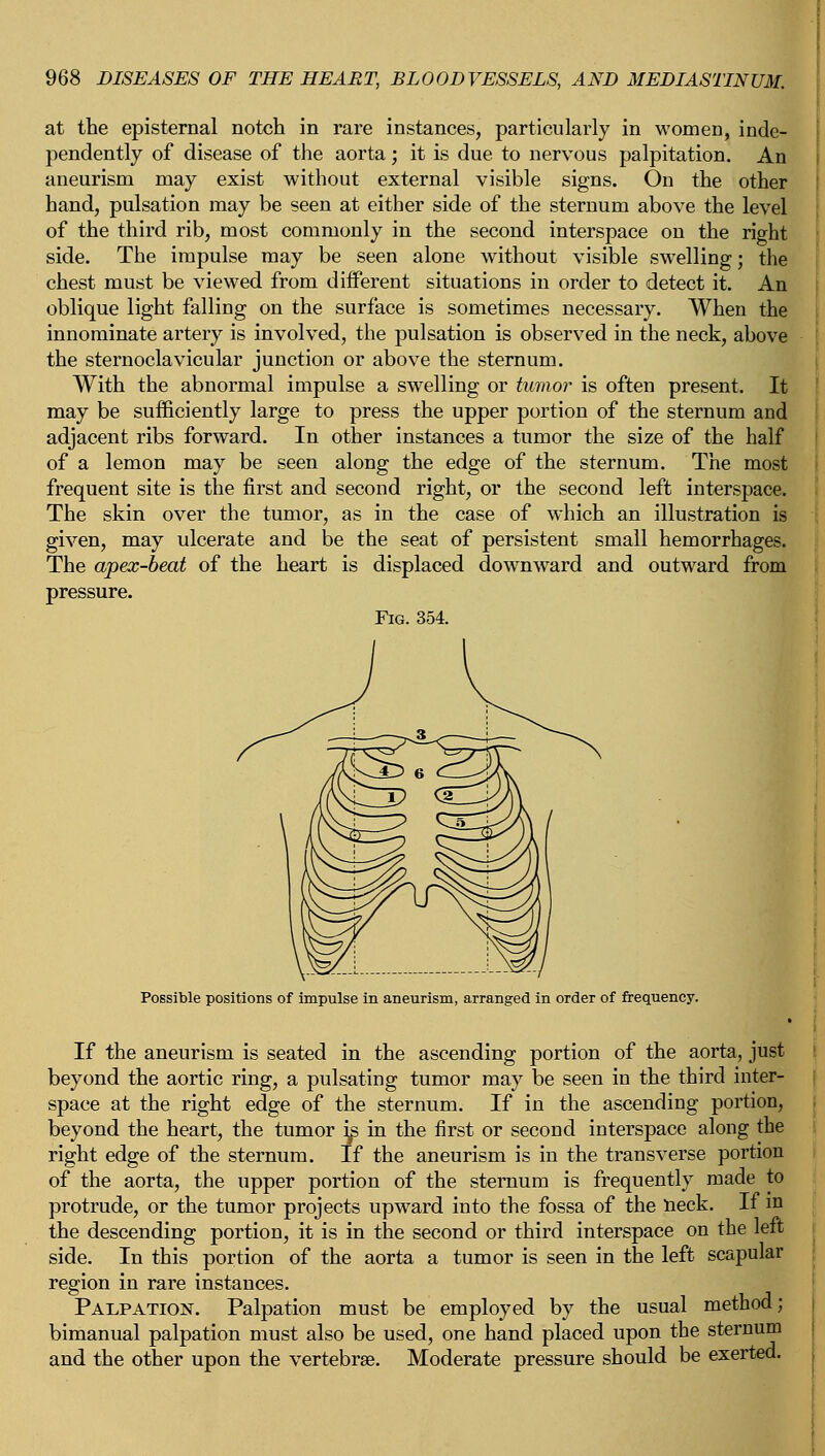 at the episternal notch in rare instances, particularly in women, inde- pendently of disease of the aorta; it is due to nervous palpitation. An aneurism may exist without external visible signs. On the other hand, pulsation may be seen at either side of the sternum above the level of the third rib, most commonly in the second interspace on the right side. The impulse may be seen alone without visible swelling; the chest must be viewed from different situations in order to detect it. An oblique light falling on the surface is sometimes necessary. When the innominate artery is involved, the pulsation is observed in the neck, above the sternoclavicular junction or above the sternum. With the abnormal impulse a swelling or tumor is often present. It may be sufficiently large to press the upper portion of the sternum and adjacent ribs forward. In other instances a tumor the size of the half of a lemon may be seen along the edge of the sternum. The most frequent site is the first and second right, or the second left interspace. The skin over the tumor, as in the case of which an illustration is given, may ulcerate and be the seat of persistent small hemorrhages. The apex-beat of the heart is displaced downward and outward from pressure. Fig. 354. Possible positions of impulse in aneurism, arranged in order of frequency. If the aneurism is seated in the ascending portion of the aorta, just beyond the aortic ring, a pulsating tumor may be seen in the third inter- space at the right edge of the sternum. If in the ascending portion, beyond the heart, the tumor ^s in the first or second interspace along the right edge of the sternum. If the aneurism is in the transverse portion of the aorta, the upper portion of the sternum is frequently made to protrude, or the tumor projects upward into the fossa of the neck. If in the descending portion, it is in the second or third interspace on the left side. In this portion of the aorta a tumor is seen in the left scapular region in rare instances. Palpation. Palpation must be employed by the usual method; bimanual palpation must also be used, one hand placed upon the sternum and the other upon the vertebra?. Moderate pressure should be exerted.