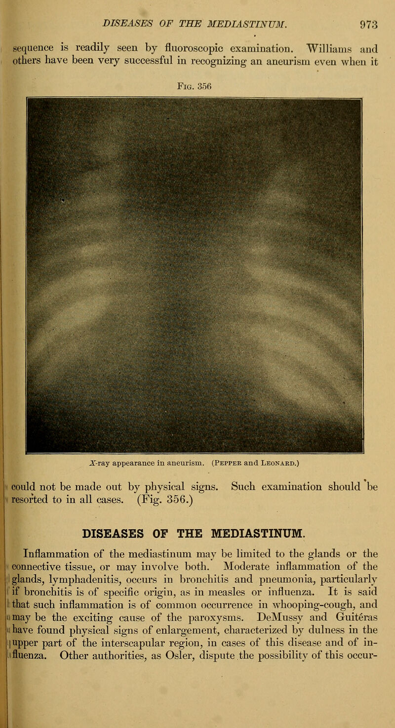 sequence is readily seen by fluoroscopic examination. Williams and others have been very successful in recognizing an aneurism even when it X-ray appearance in aneurism. (Pepper and Leonard.) could not be made out by physical signs. Such examination should be resorted to in all cases. (Fig. 356.) DISEASES OF THE MEDIASTINUM. Inflammation of the mediastinum may be limited to the glands or the connective tissue, or may involve both. Moderate inflammation of the I glands, lymphadenitis, occurs in bronchitis and pneumonia, particularly if bronchitis is of specific origin, as in measles or influenza. It is said I that such inflammation is of common occurrence in whooping-cough, and may be the exciting cause of the paroxysms. DeMussy and Guiteras have found physical signs of enlargement, characterized by dulness in the upper part of the interscapular region, in cases of this disease and of in- fluenza. Other authorities, as Osier, dispute the possibility of this occur-